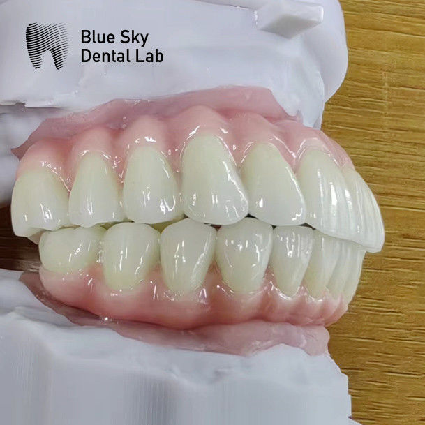 Blue Sky Implant Cases With Malo Frame Bridge Pure Titanium 1
