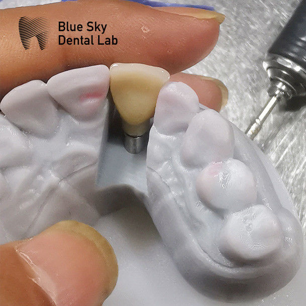 Regular Implant Cases Universal Compatibility Dental Implant Case 0