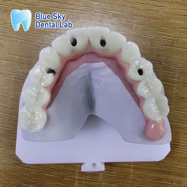Regular Implanted Device Cases Steam Sterilization Implant Cases 1