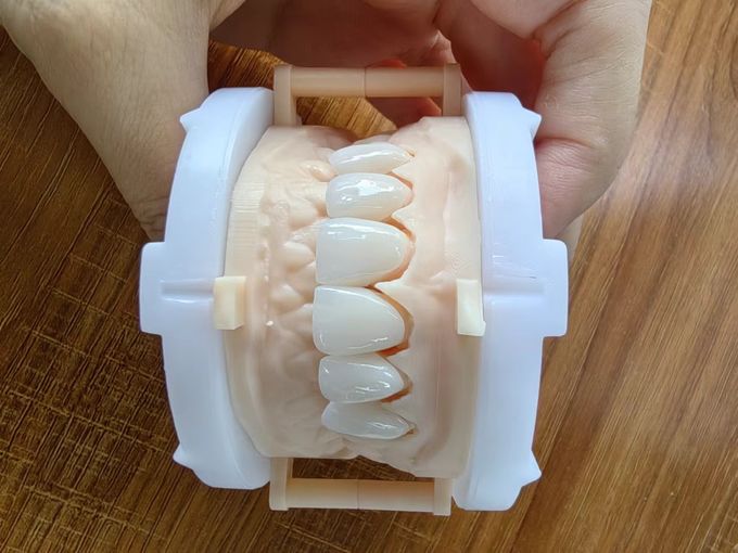 Highly Translucent Layered Zirconia Crowns Natural With Implant Crown 1