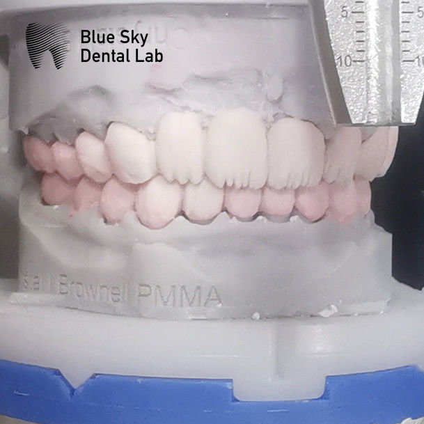Rectangular Layered Zirconia Teeth Multilayer Before Glazing 1