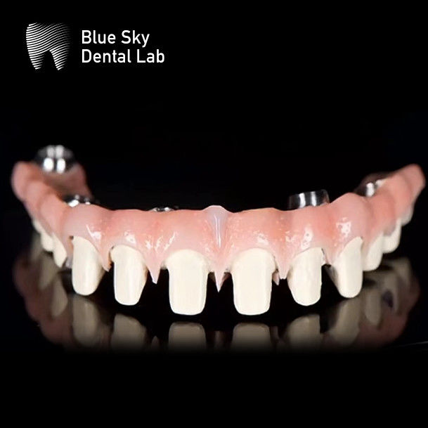 Customizable Pure Titanium Malo Bridge Dental Blue Sky Implant System 1
