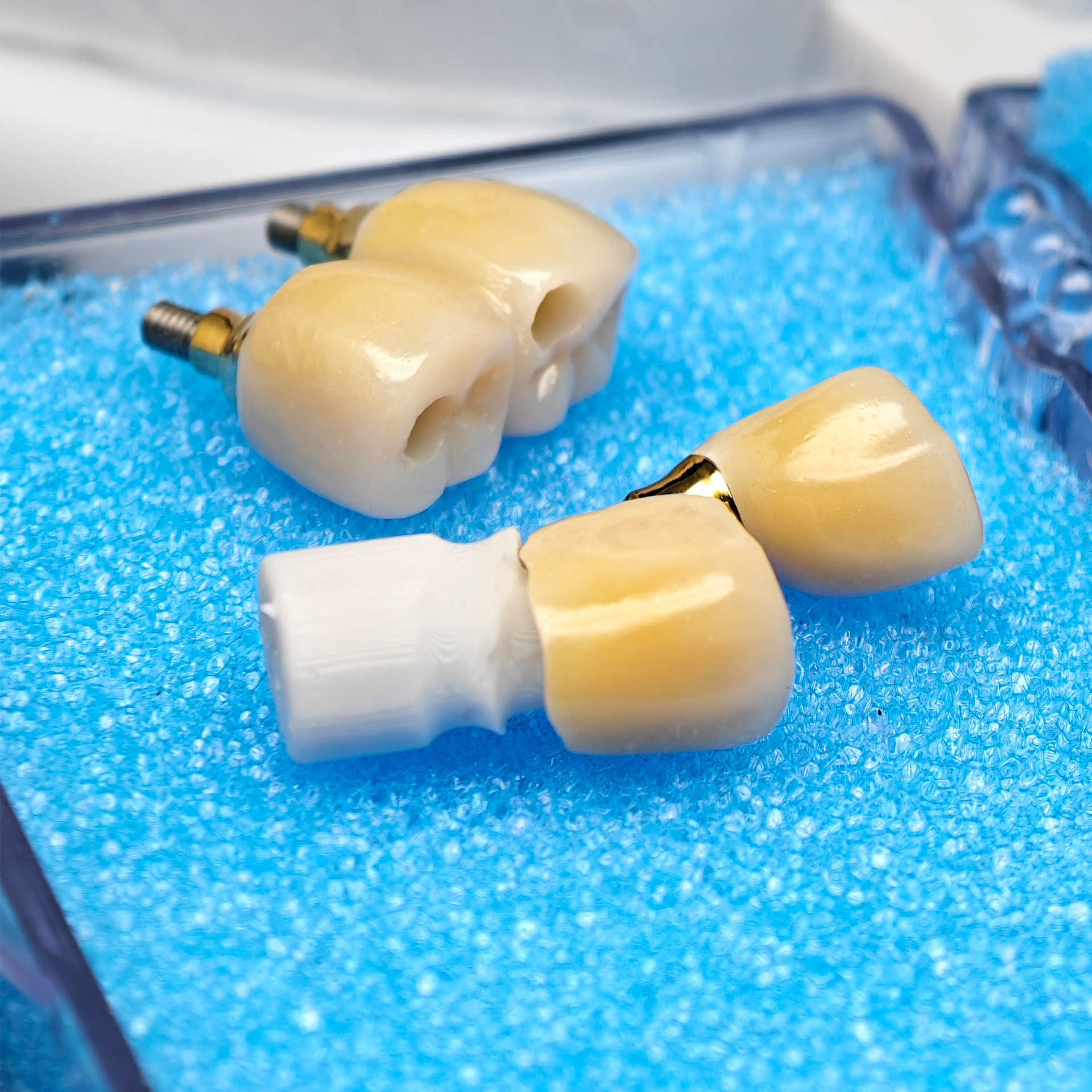 Custom Zirconia Implant Crown 