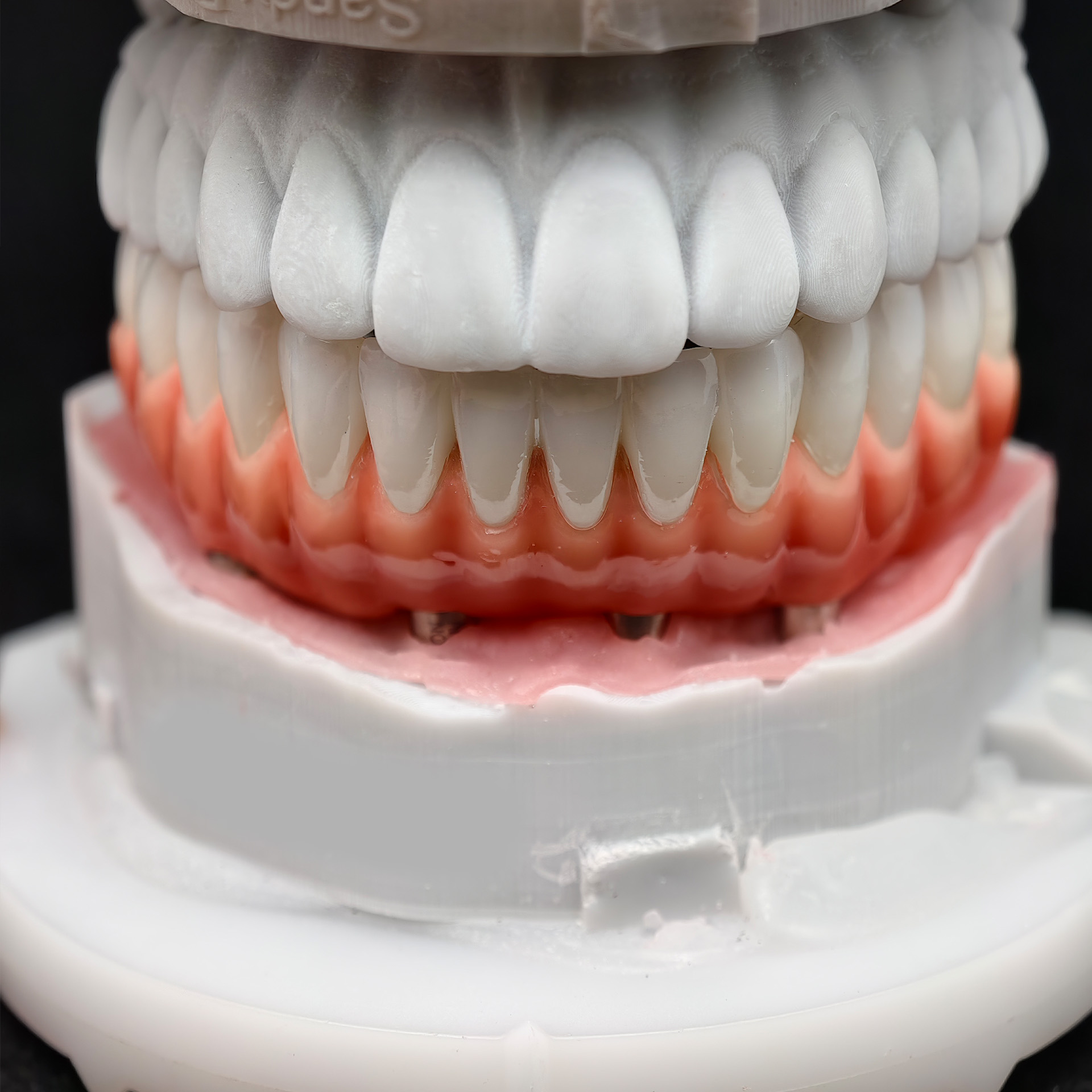 Zirconia-Enamel Hybrid Malo Br