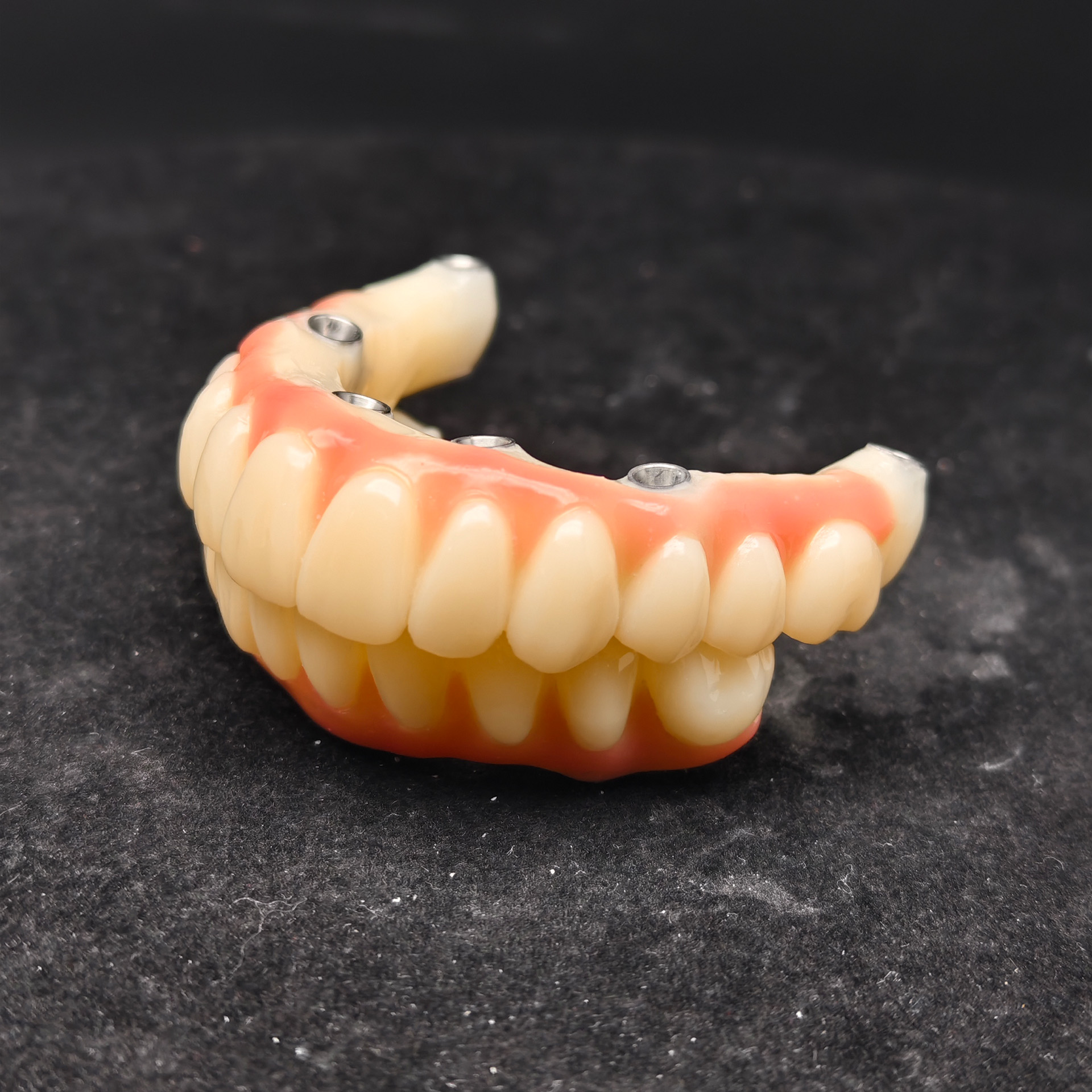 PMMA bridge with Ti-base screw