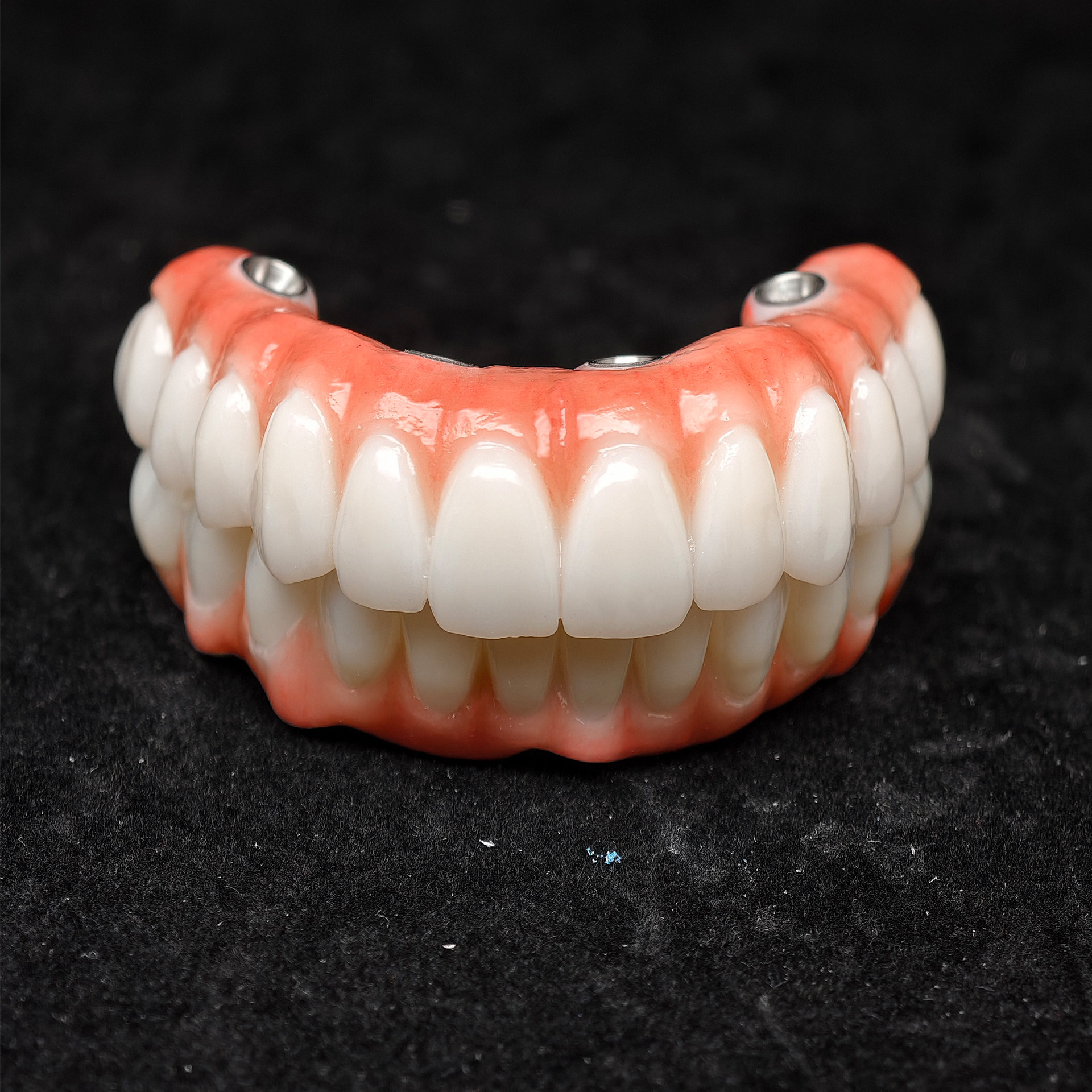all on 4 zirconia bridge with 
