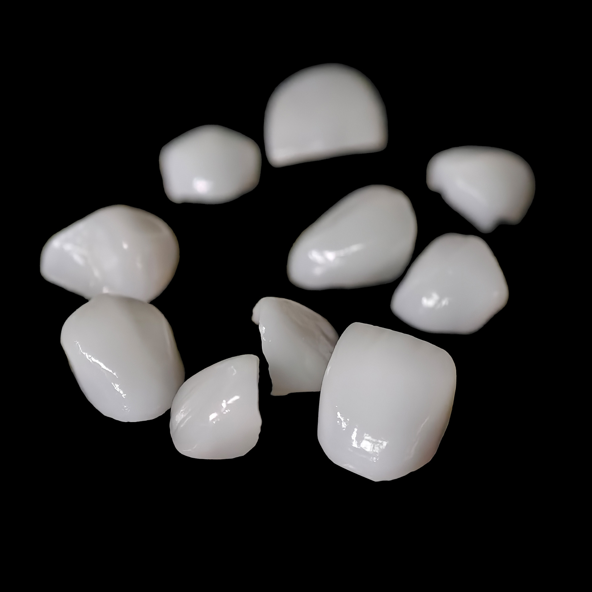 Ultra-thin emax veneer. High t