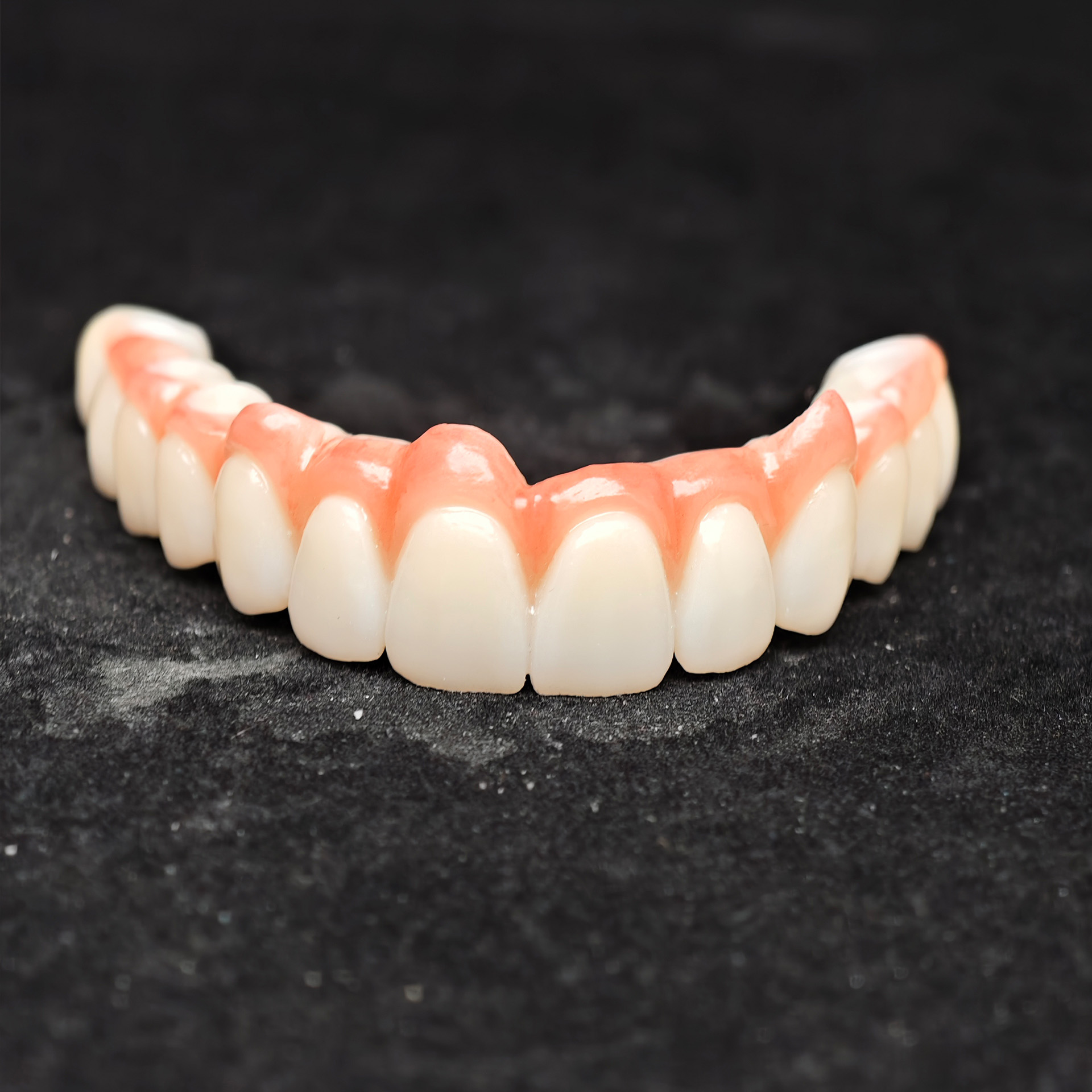 Zirconia bridge with cement re