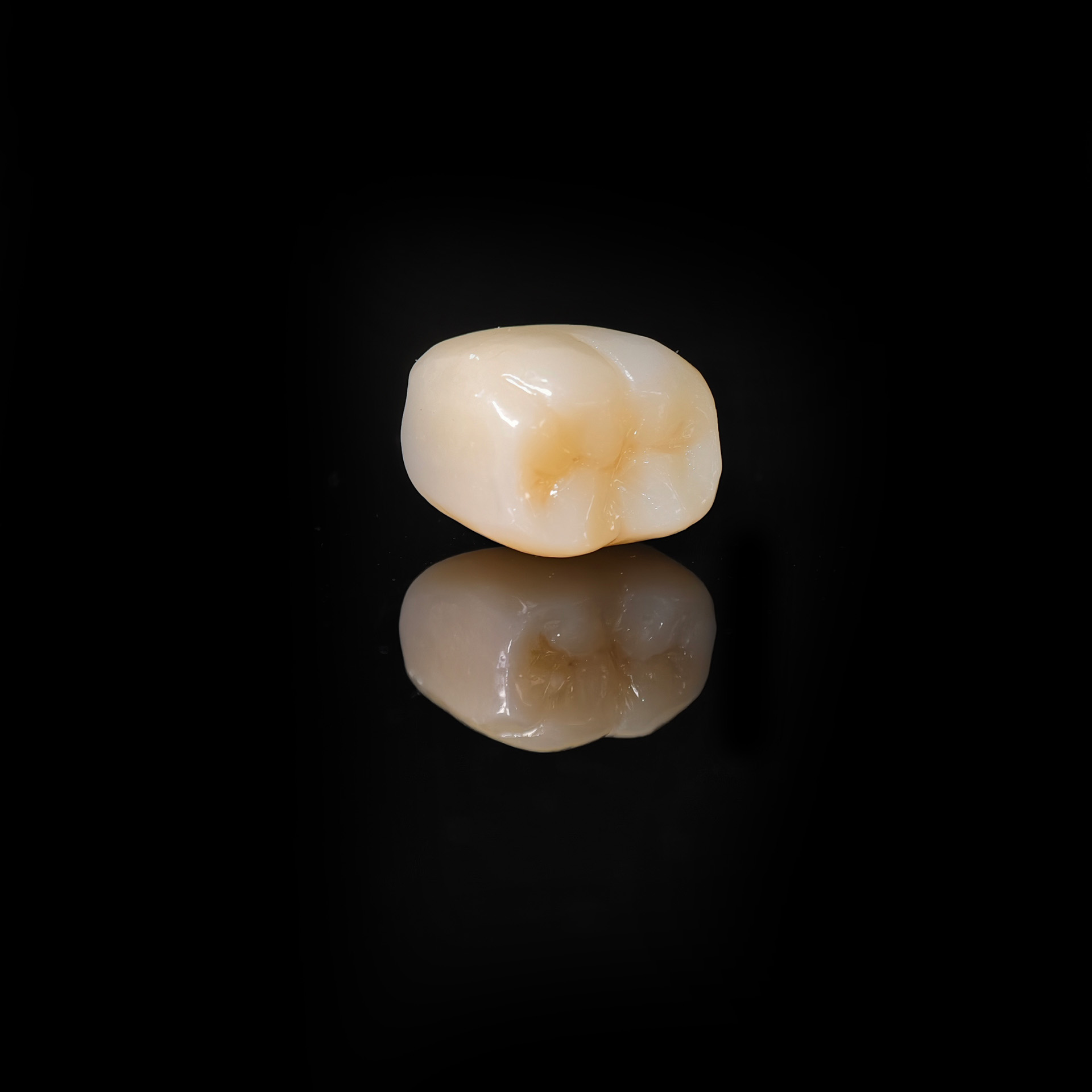 High - Strength Zirconia Denta