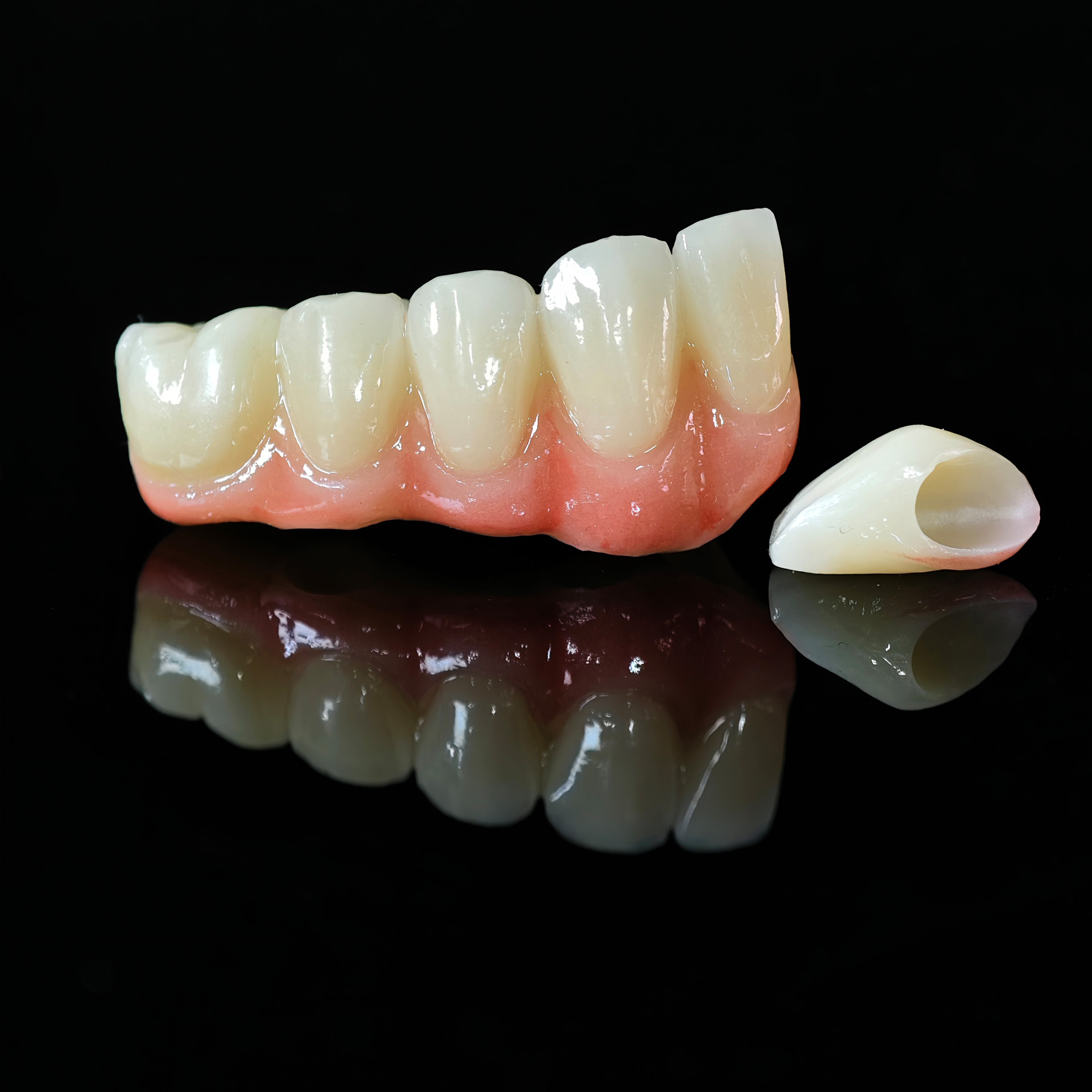 High - Strength Zirconia Crown