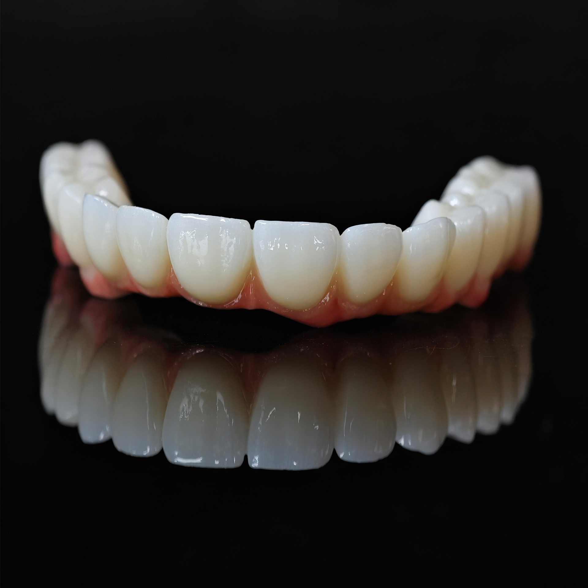 Zirconia bridge with cement re