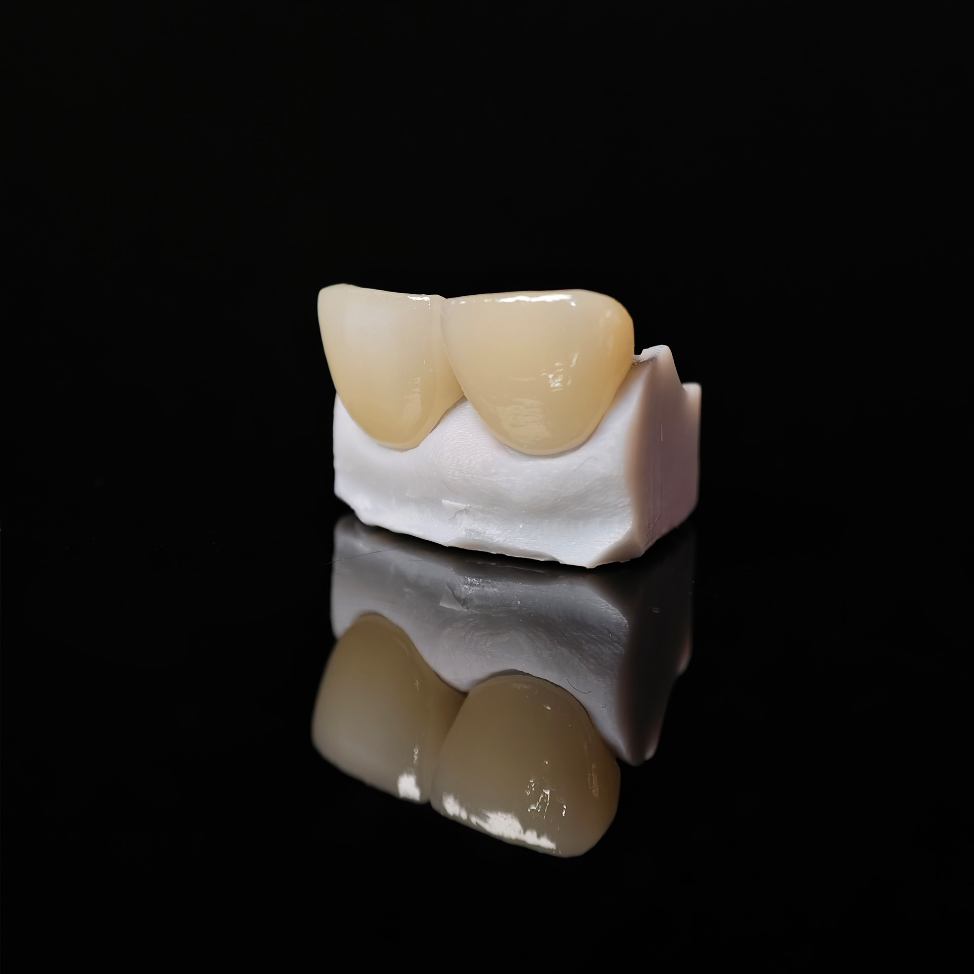 Zirconia veneer. High transpar