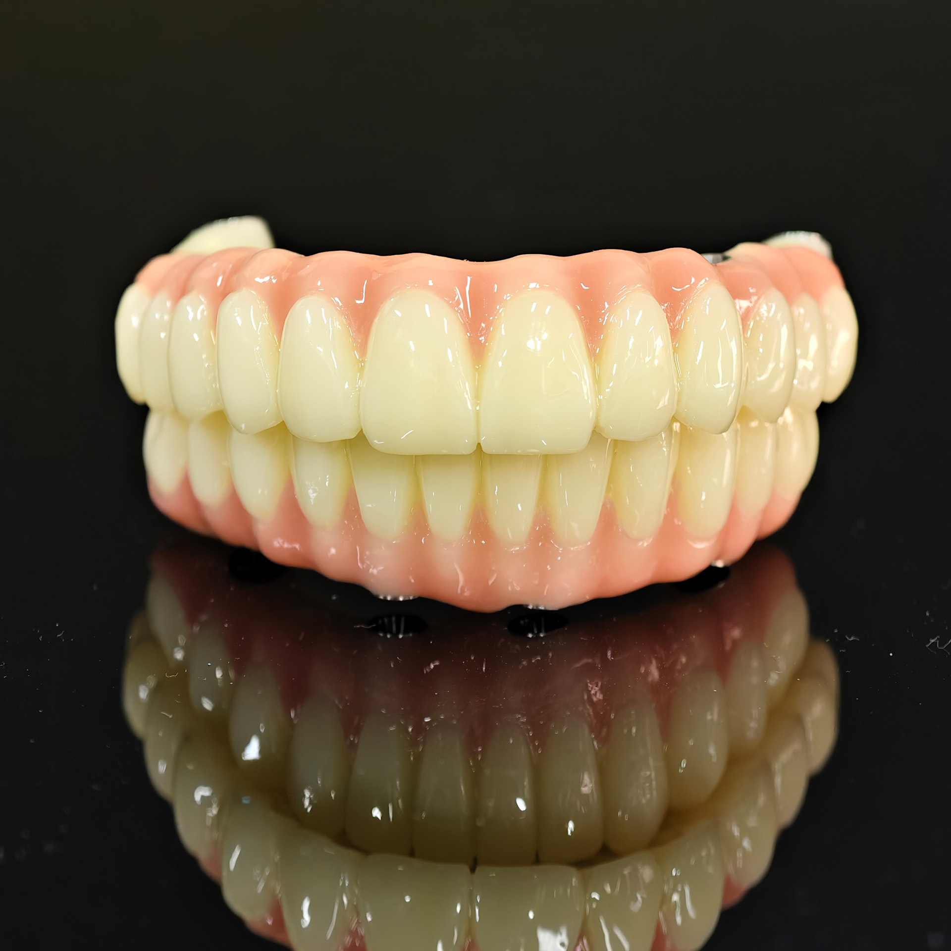 PMMA bridge with Ti-base screw