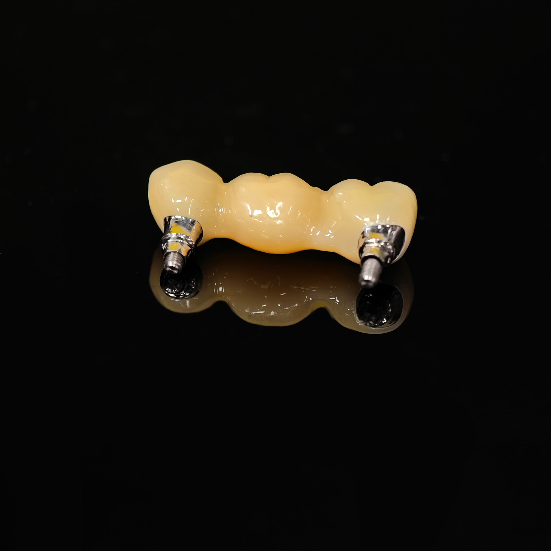 Zirconia bridge with screw ret