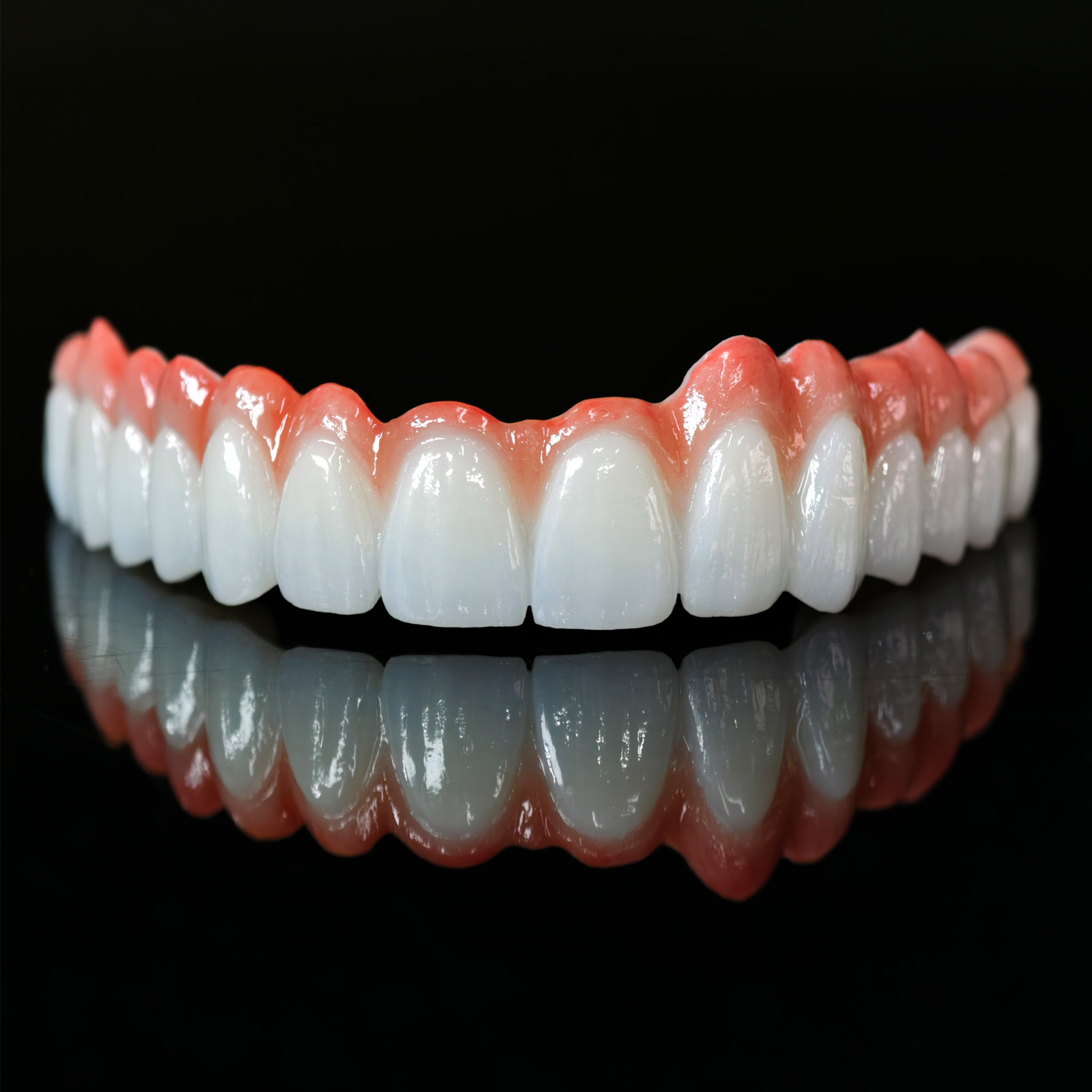 Zirconia bridge with cement re