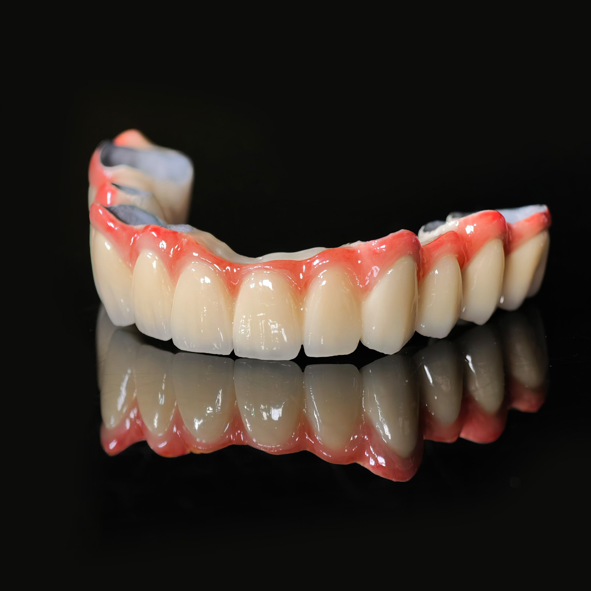 PFM bridge with cement retaine