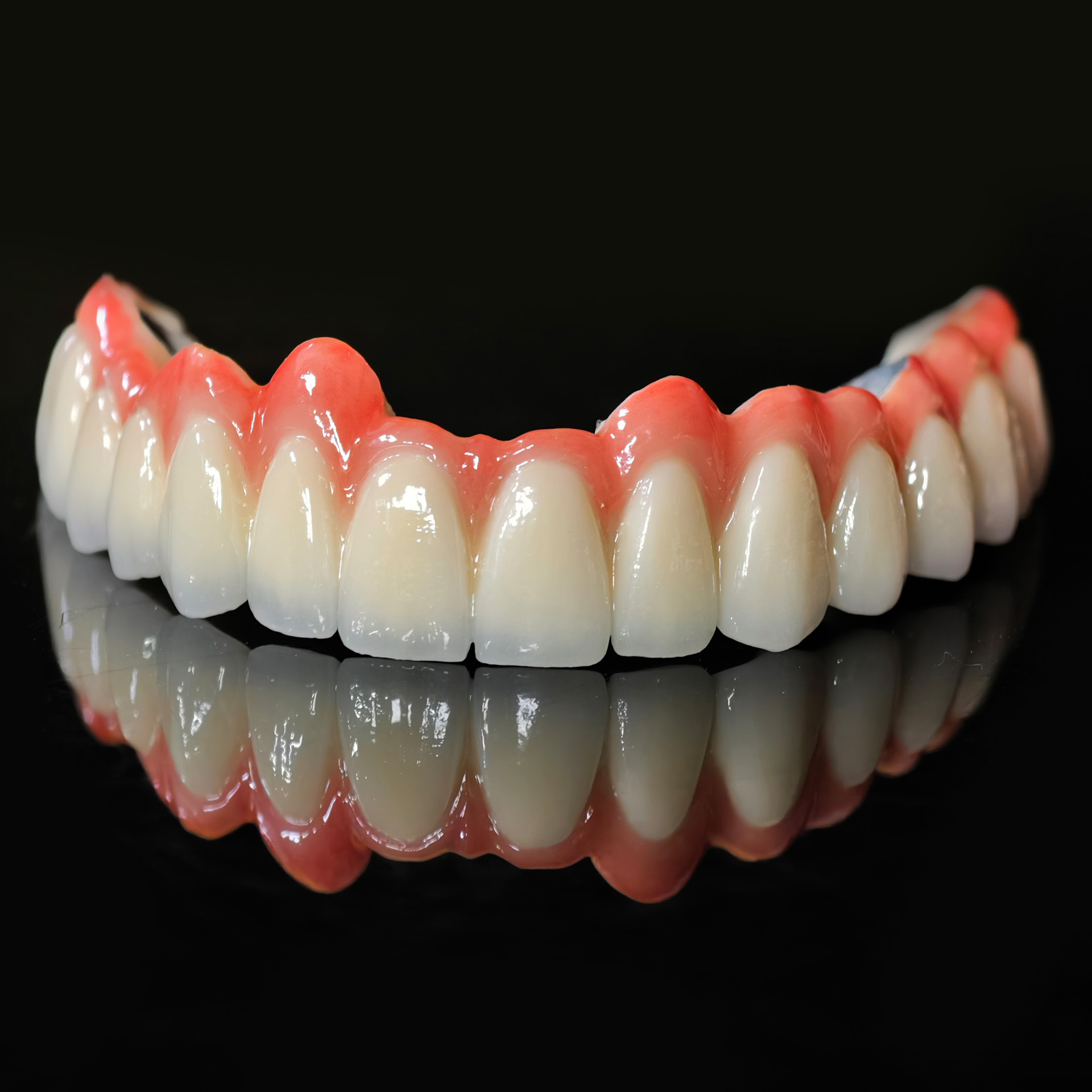 PFM bridge with cement retaine