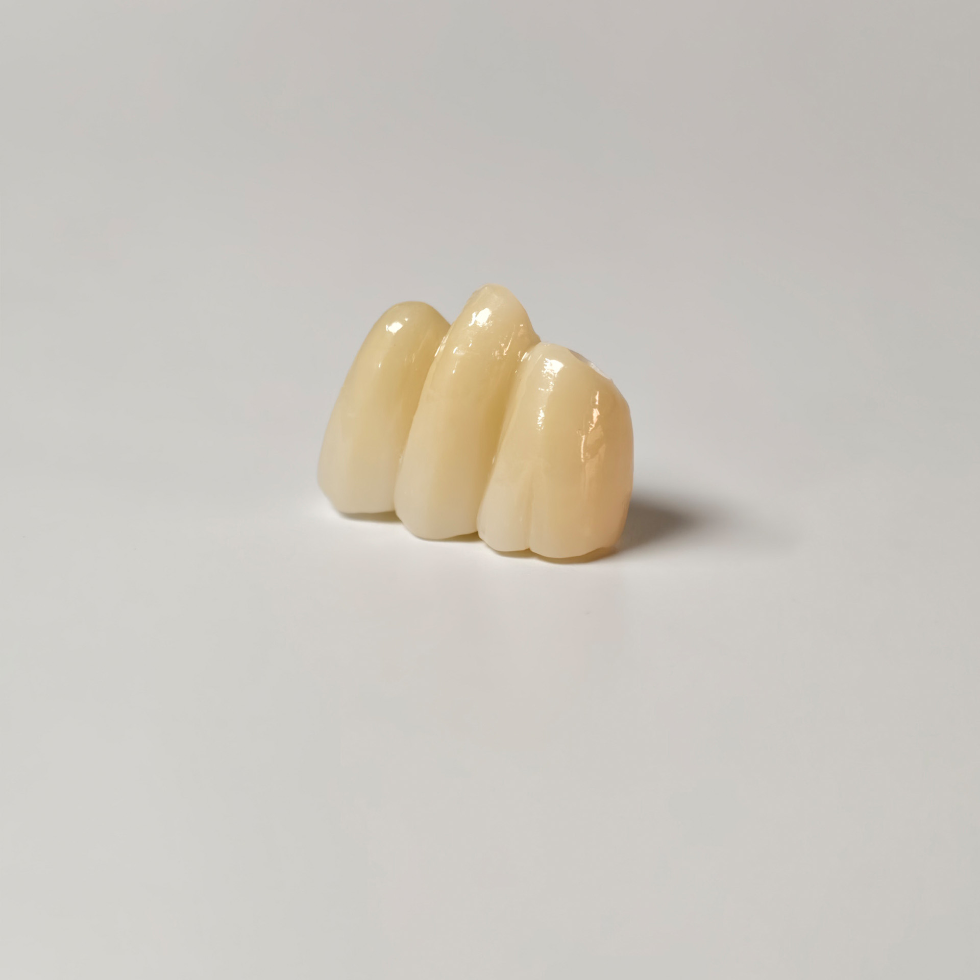 High - Strength Zirconia Bridg
