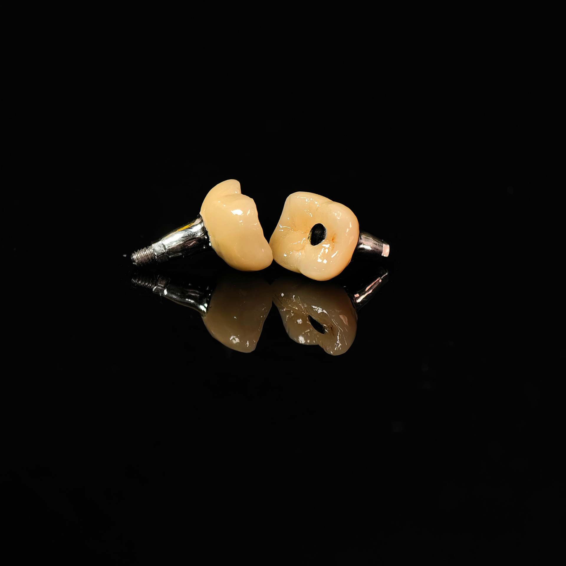 Implant-supported PFM single c