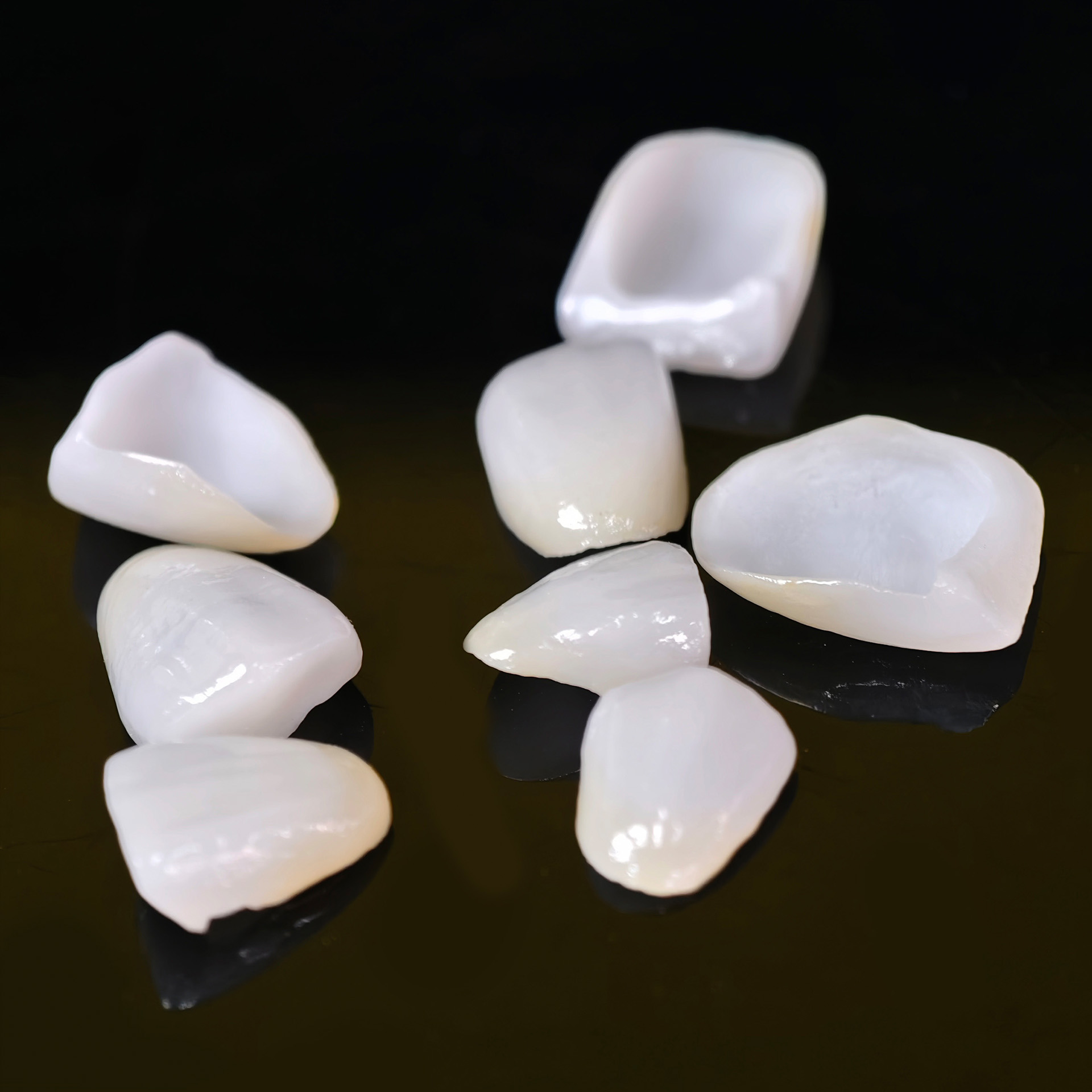 Ultra-thin emax veneer. High t