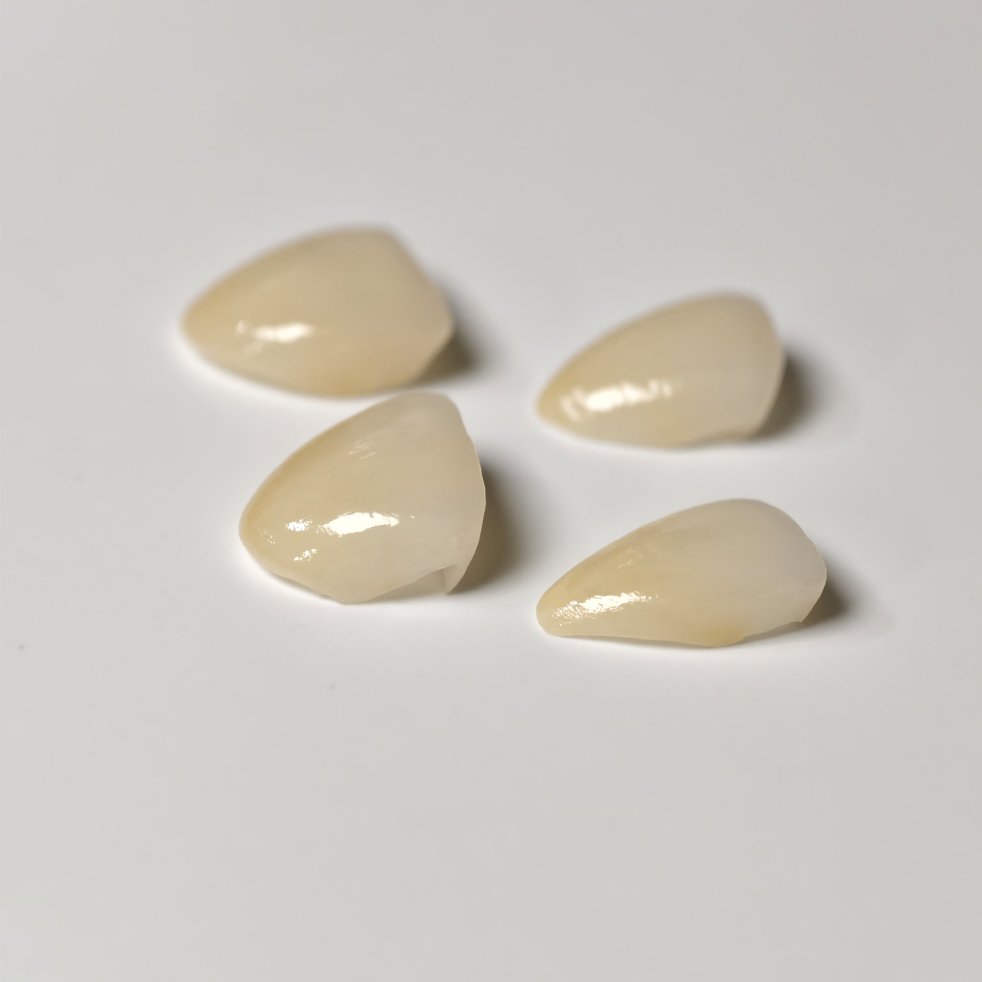 Ultra-thin emax veneer. High t