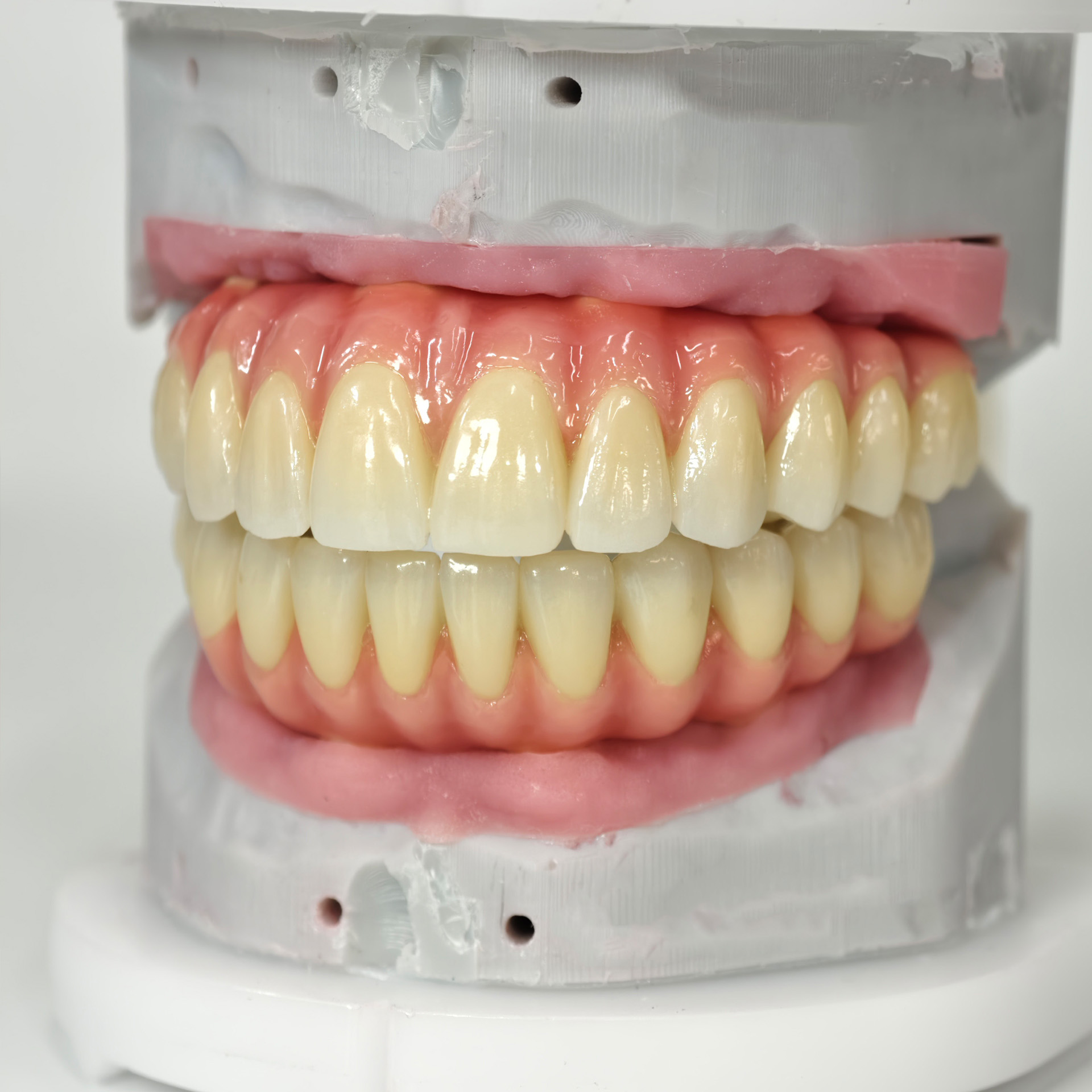 Zirconia-Enamel Hybrid Malo Br