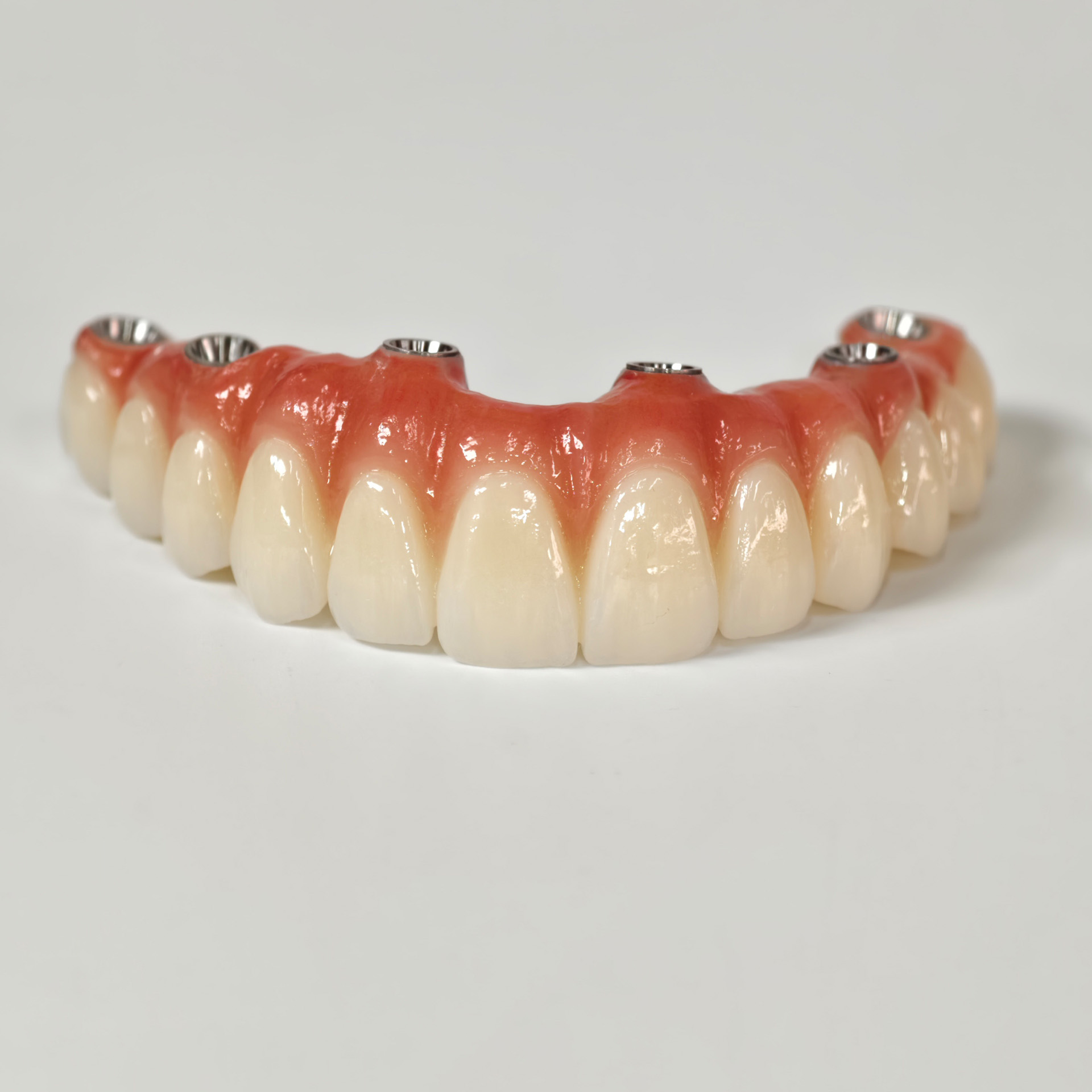 All on 6 zirconia bridge with Ti-base sc