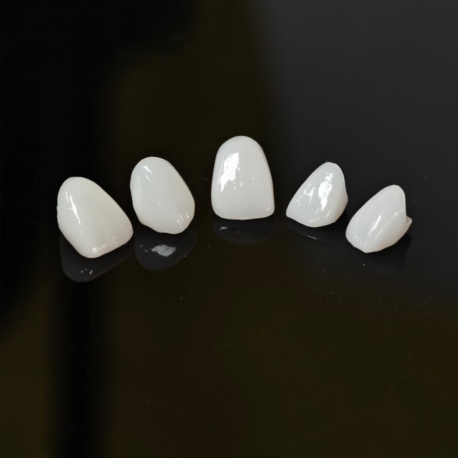 PFZ porcelain fused zirconia A