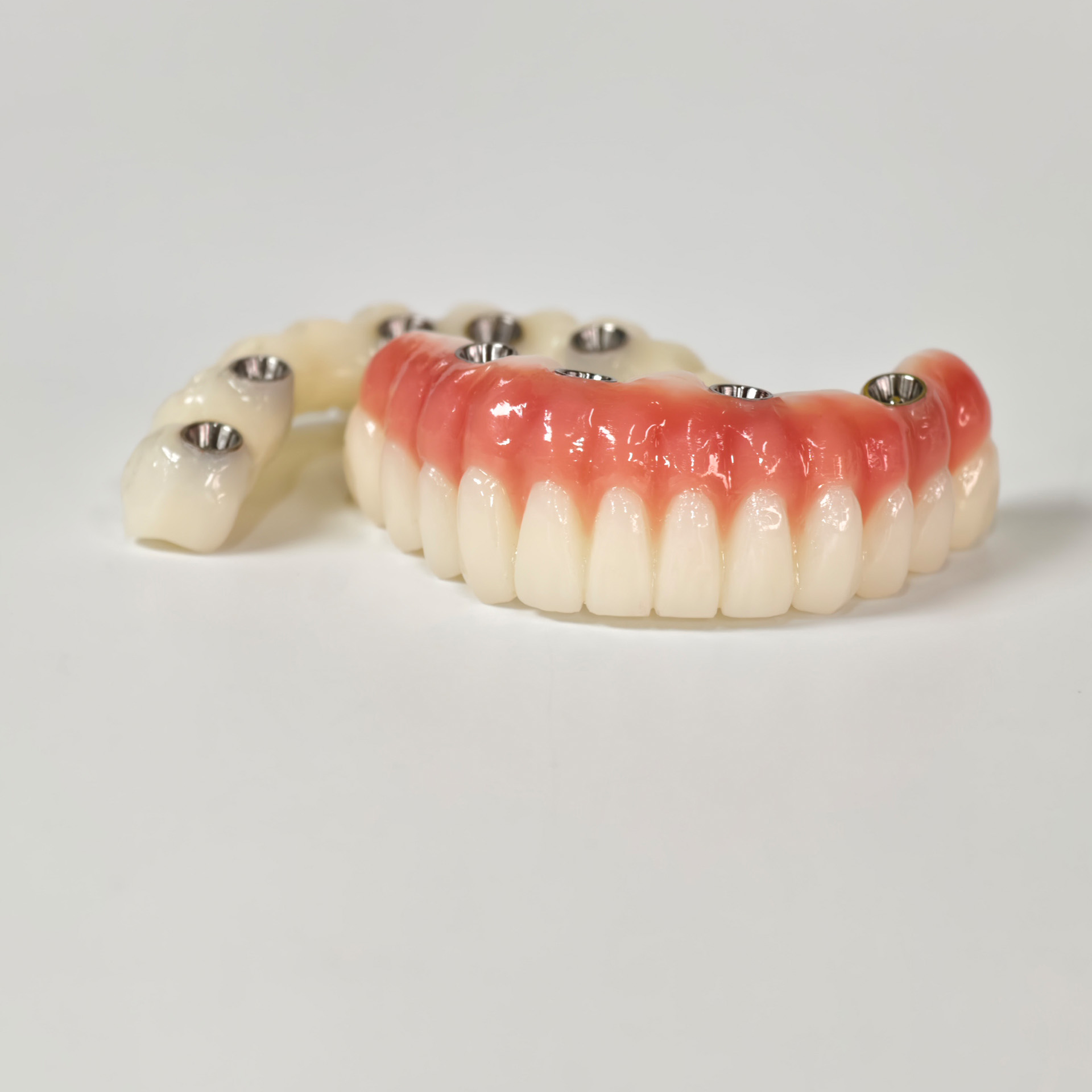 Full-arch PMMA bridge with ti-