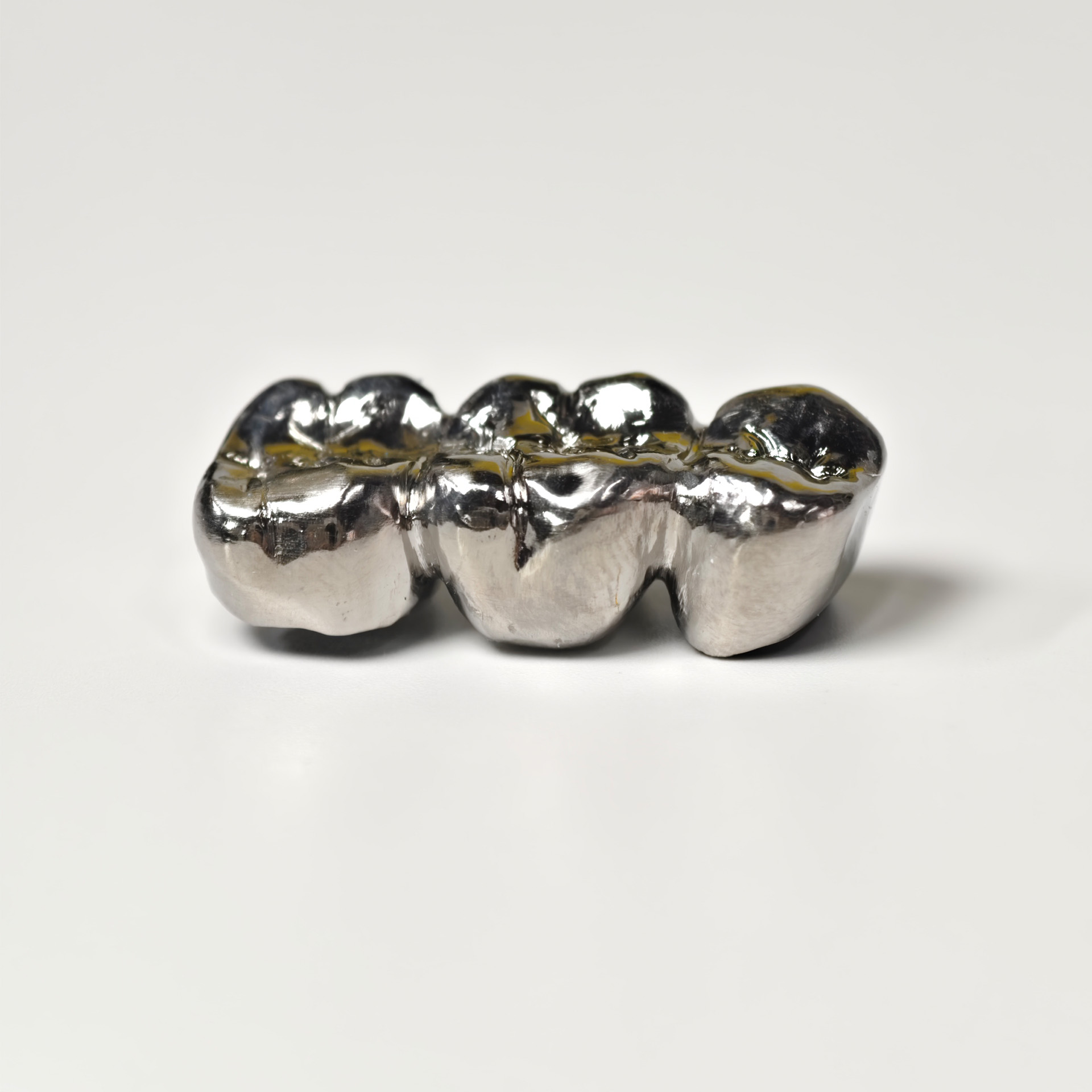 Titanium crown with cement ret