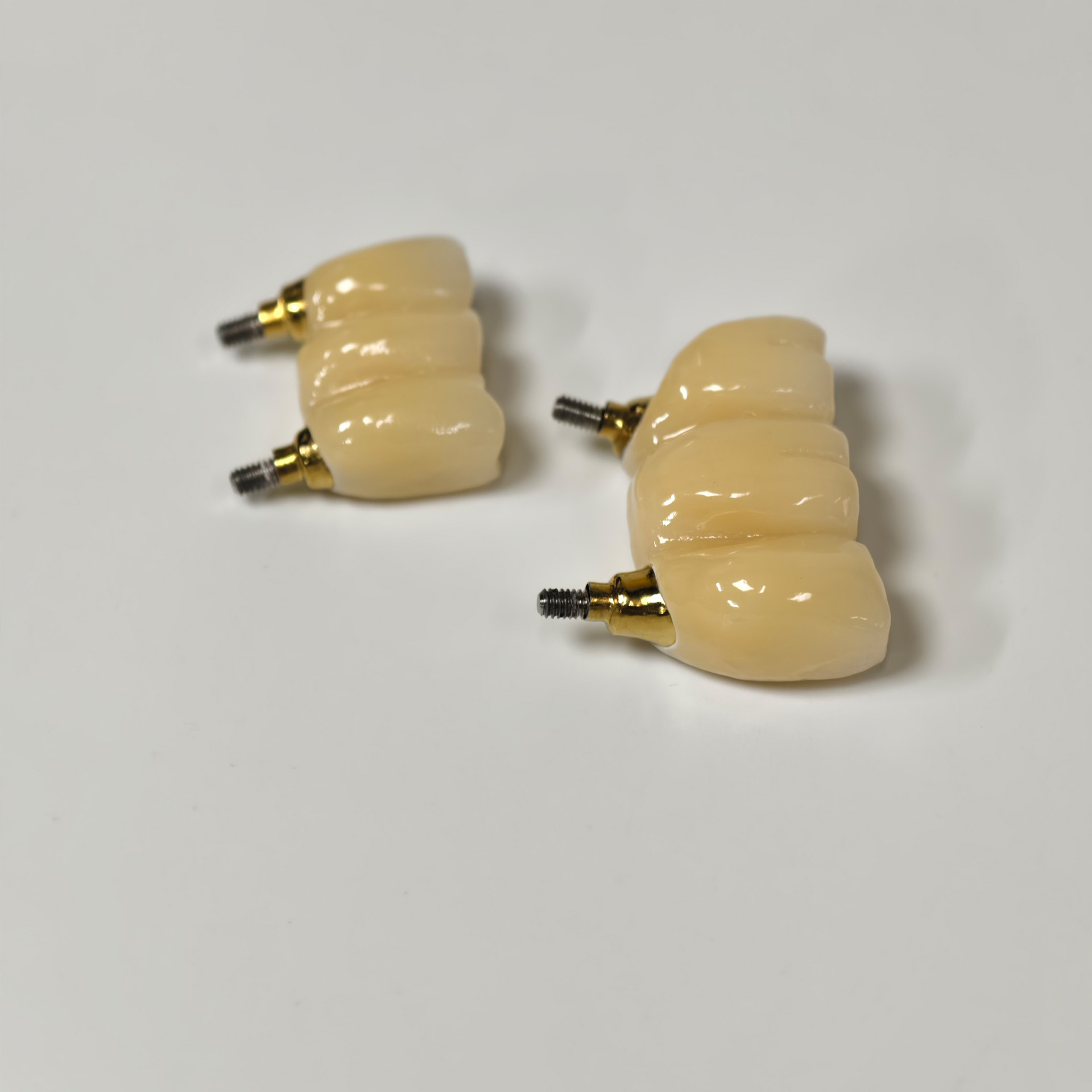 Zirconia bridges with screw retained