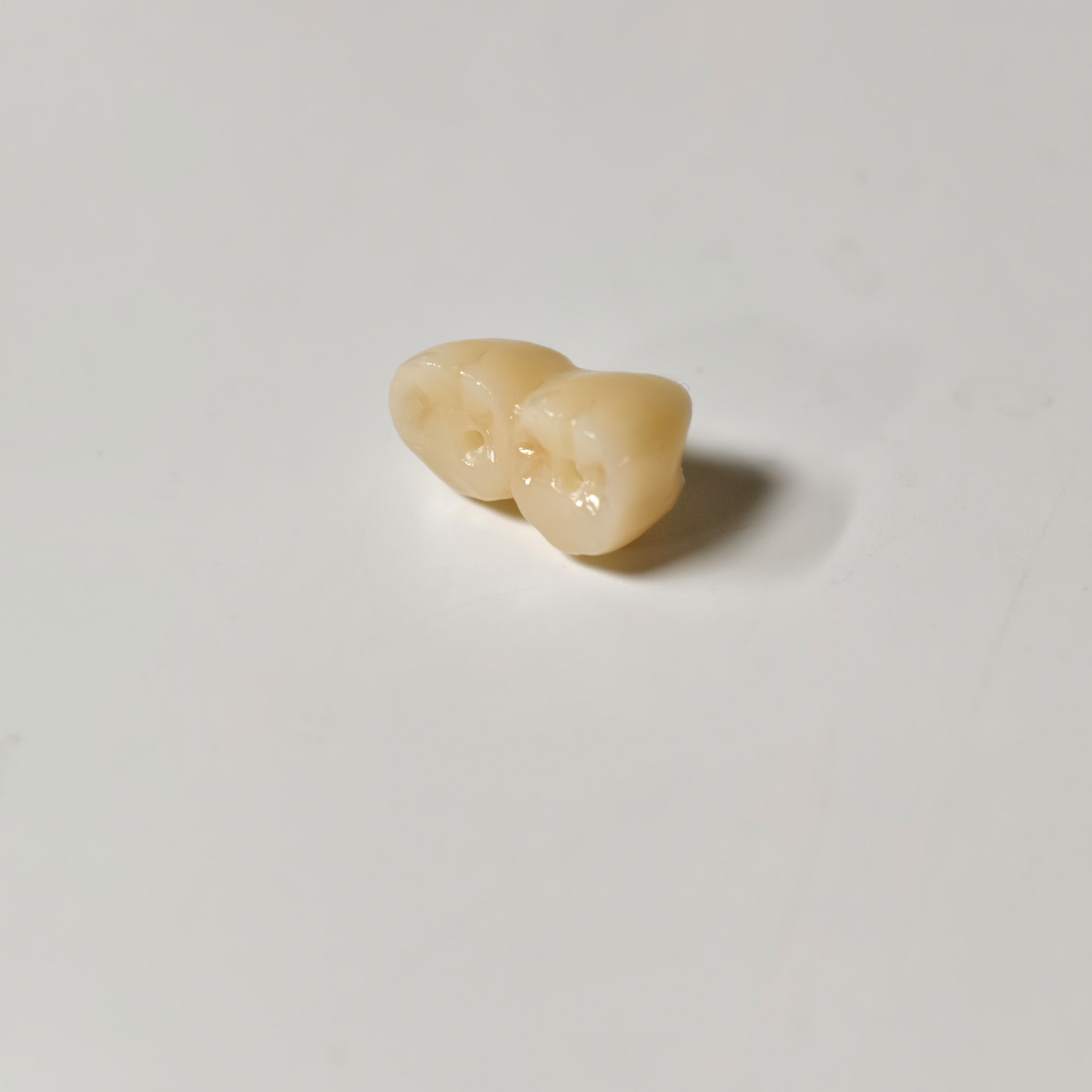 Zirconia implant bridge Screwm