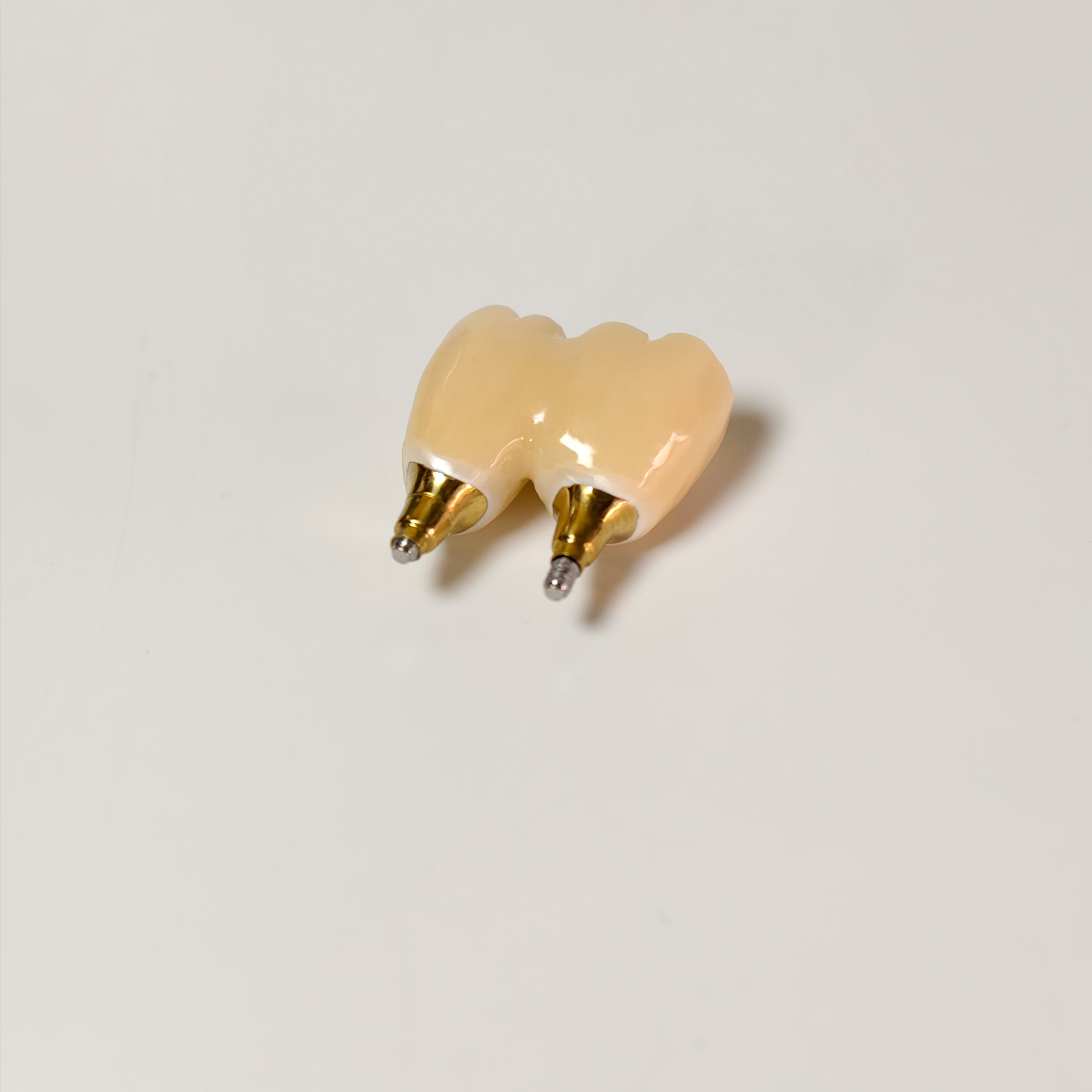 Zirconia Bridge with screw ret