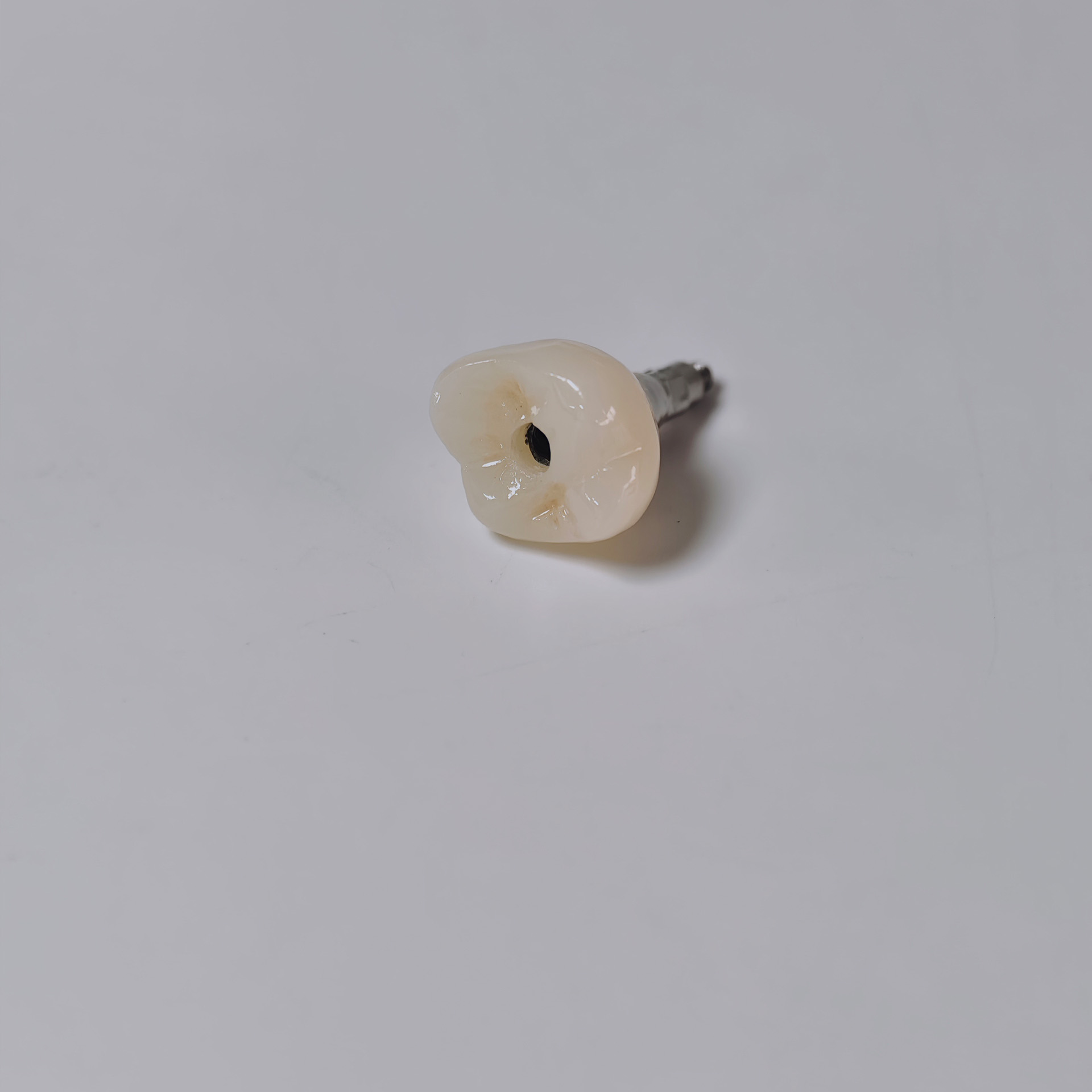 Zirconia crown with screw reta