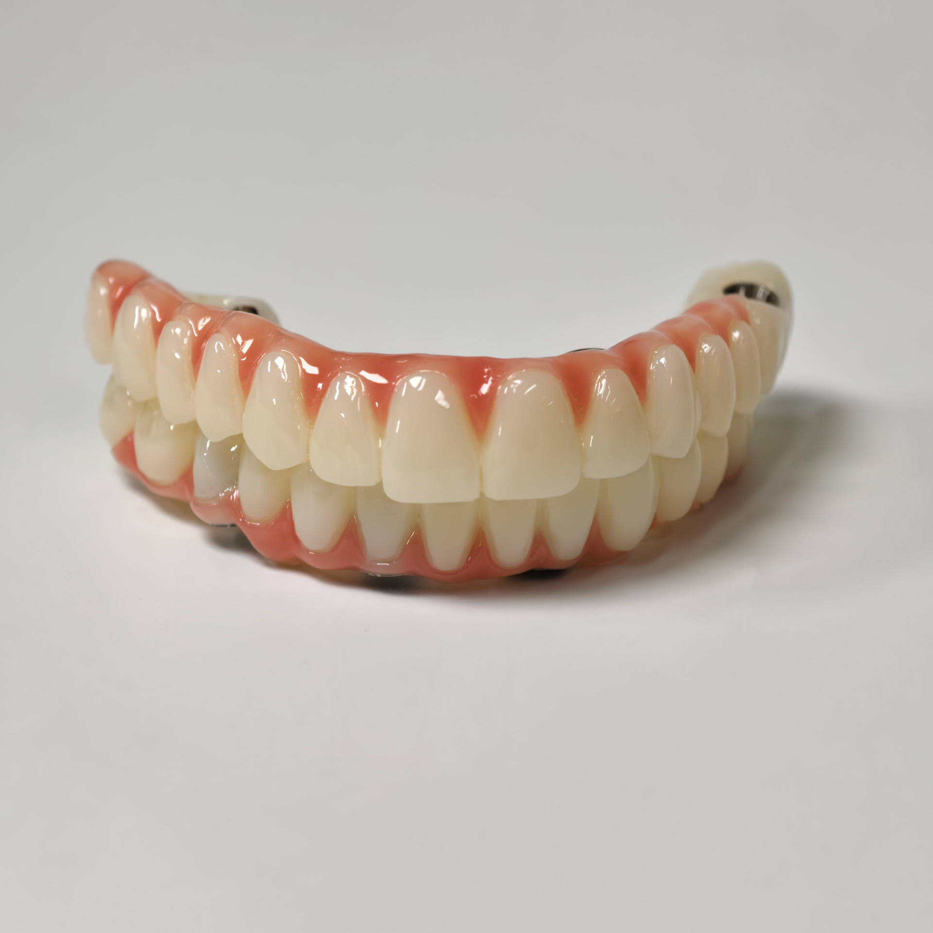 Full-arch PMMA bridge with ti-