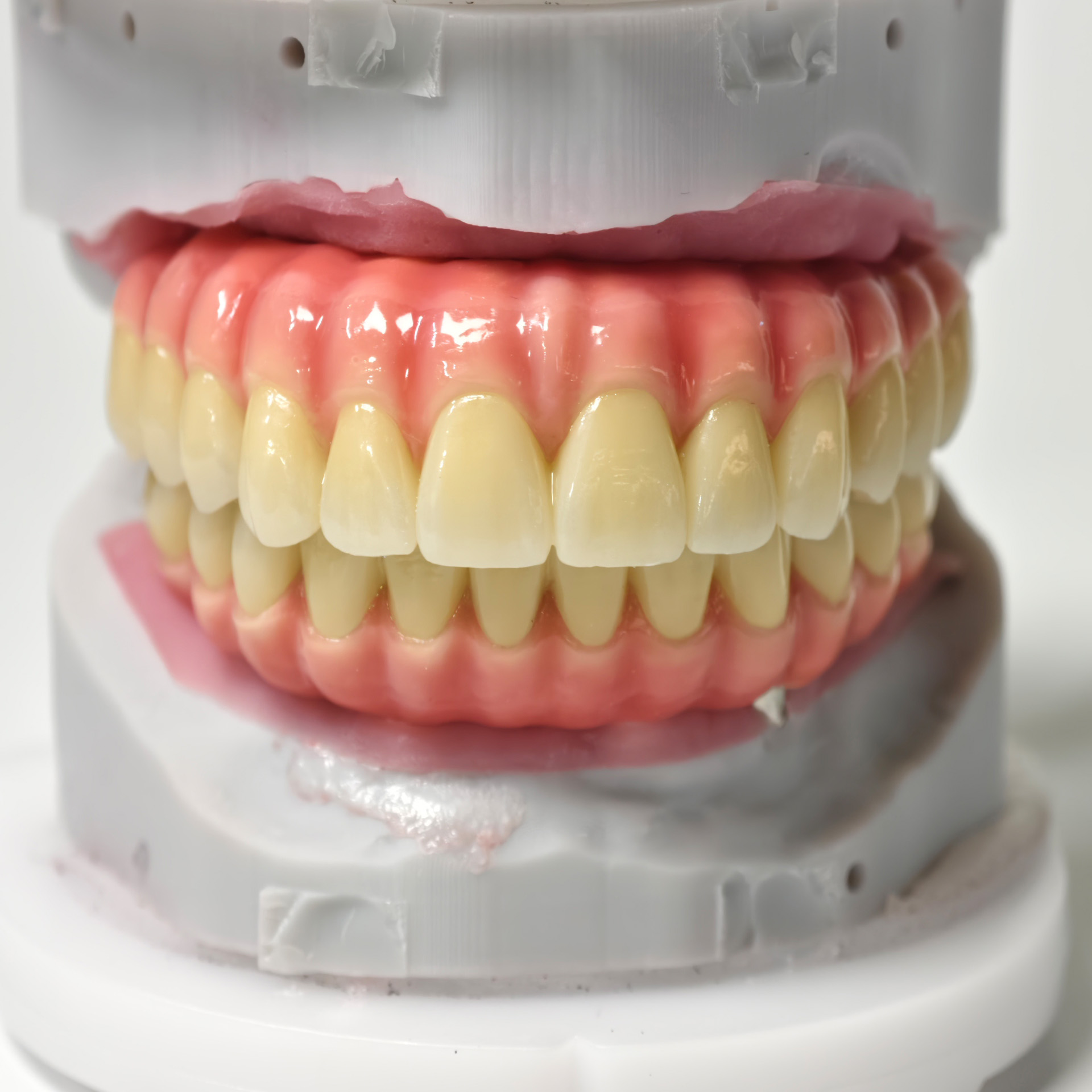 Zirconia-Enamel Hybrid Malo Br