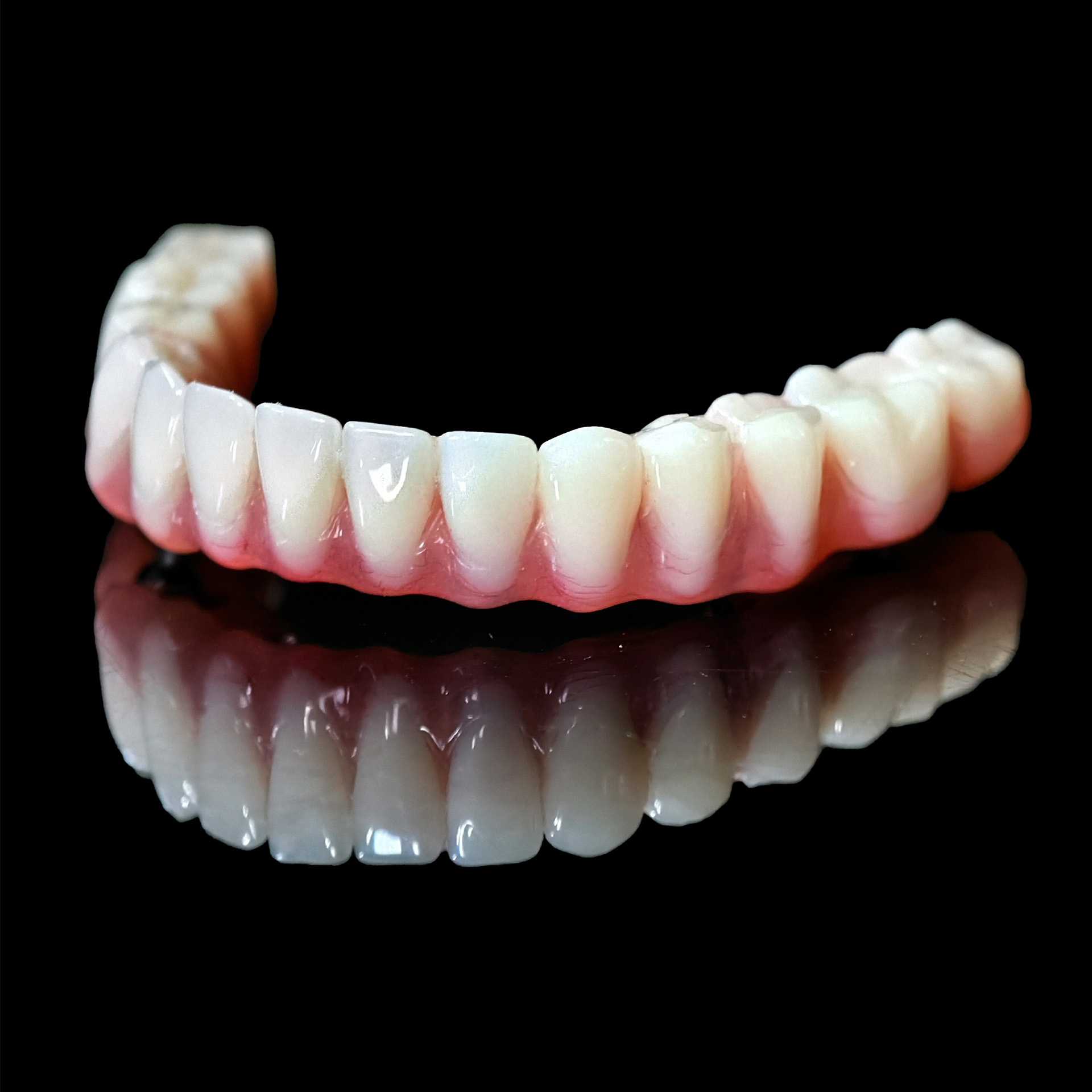 acrylic denture with screw ret