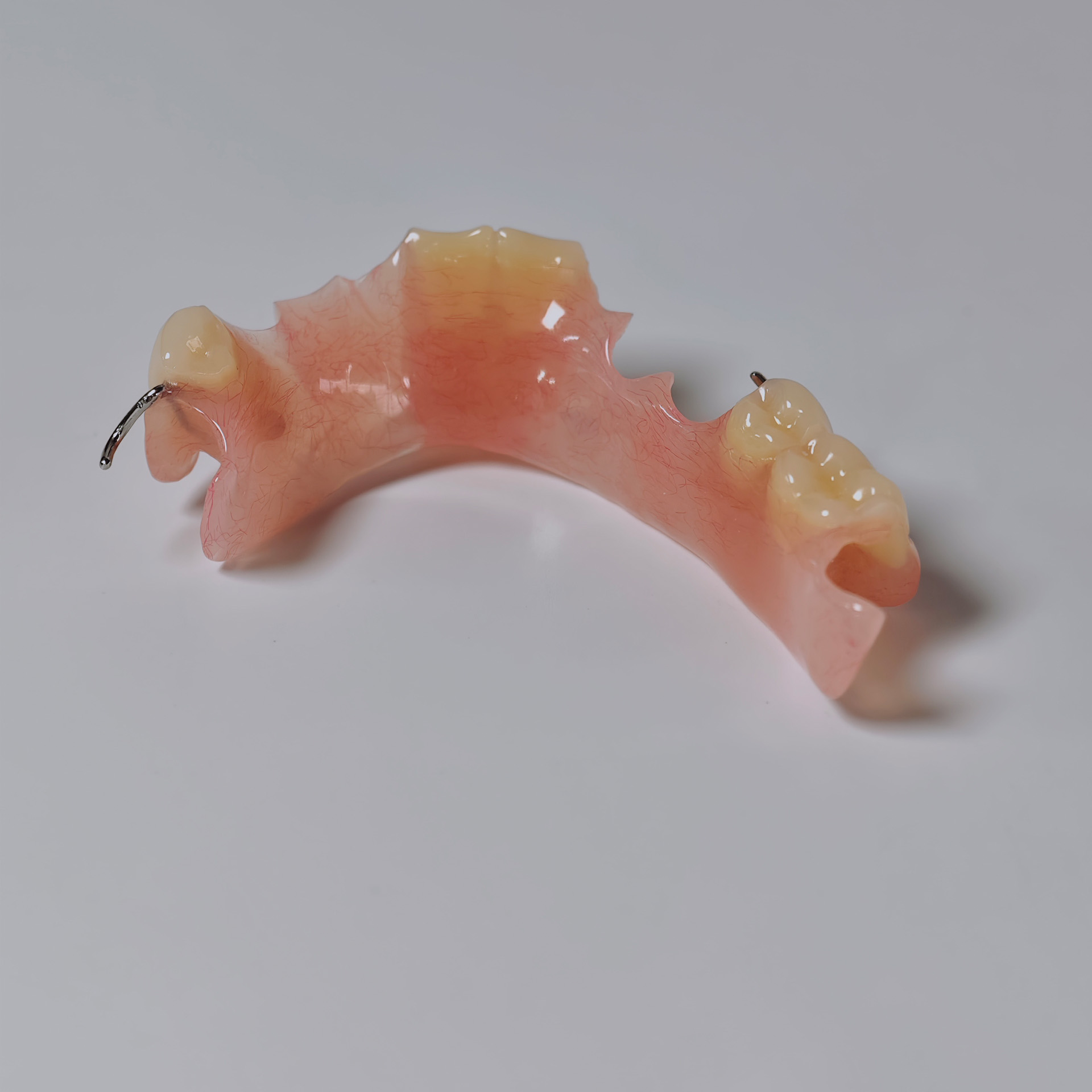 Metal clasp partial denture