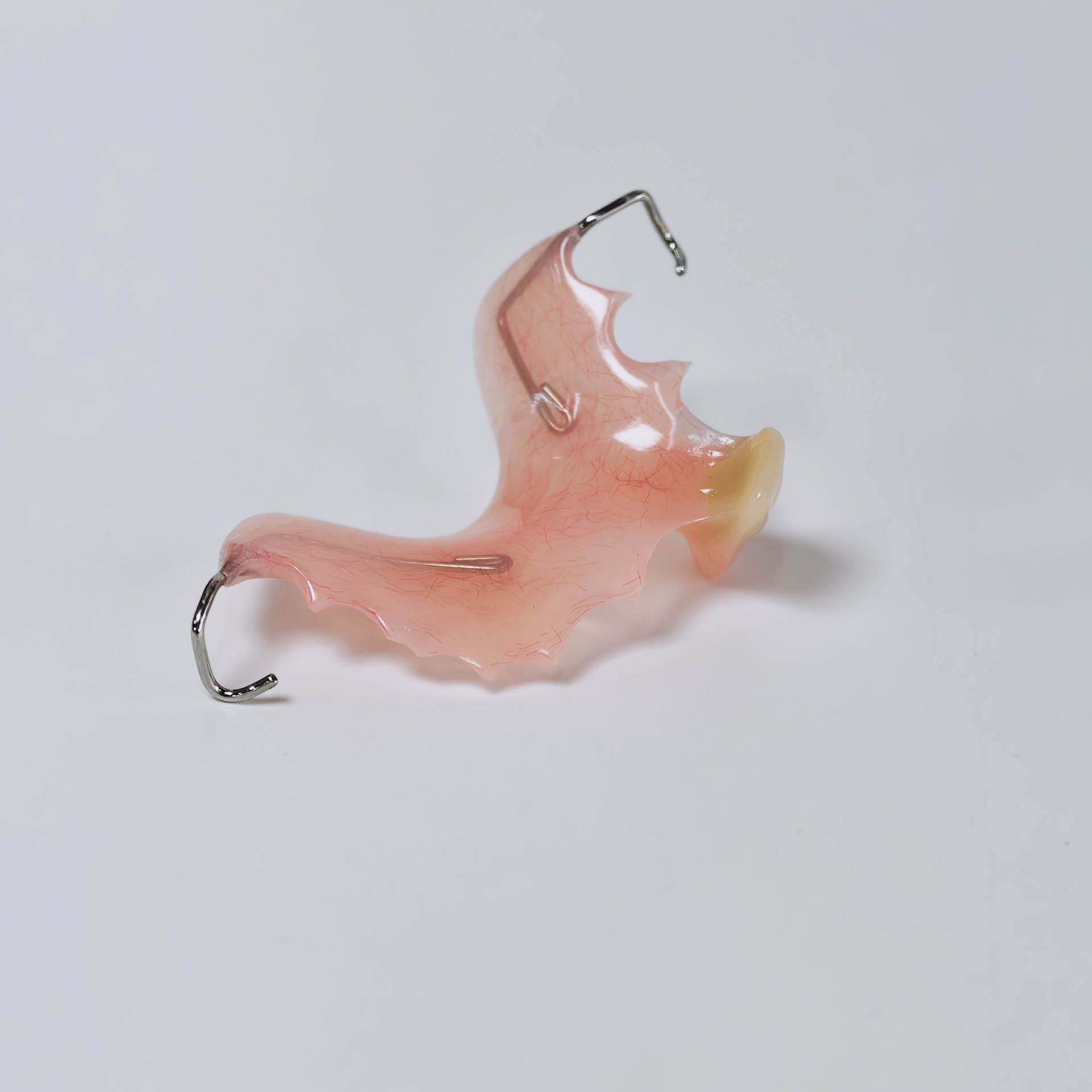 Metal clasp partial denture