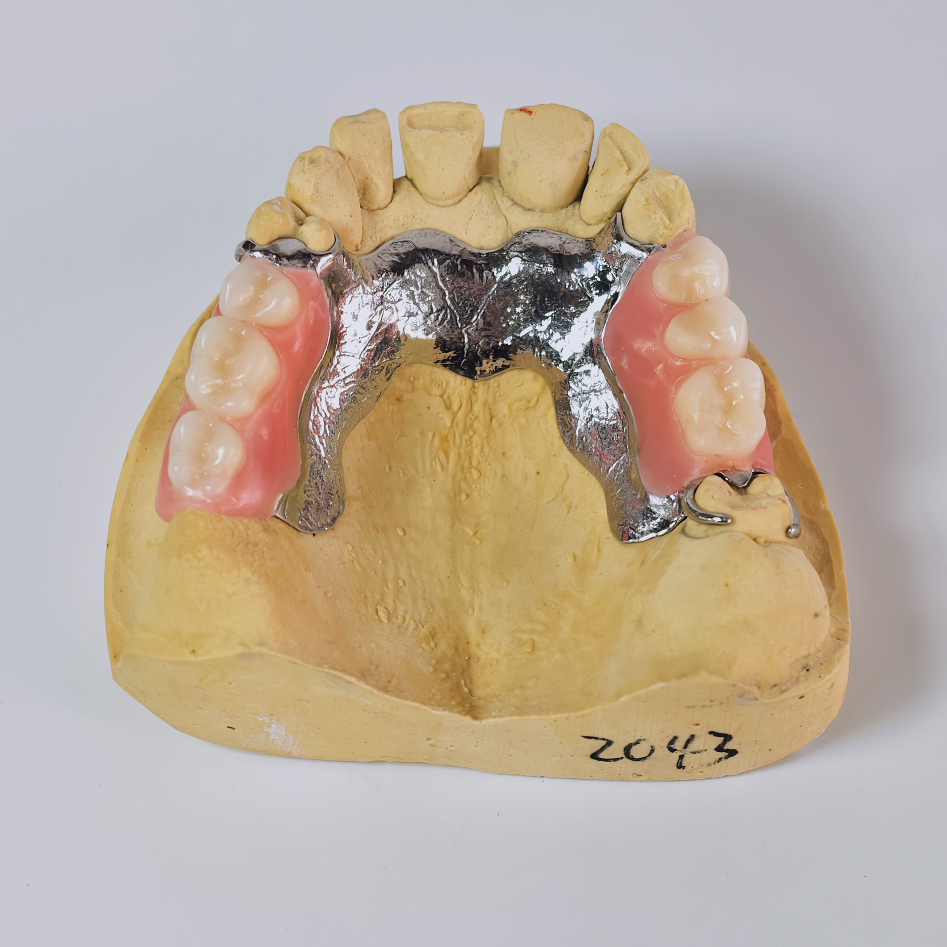 Cobalt chrome framework dentur