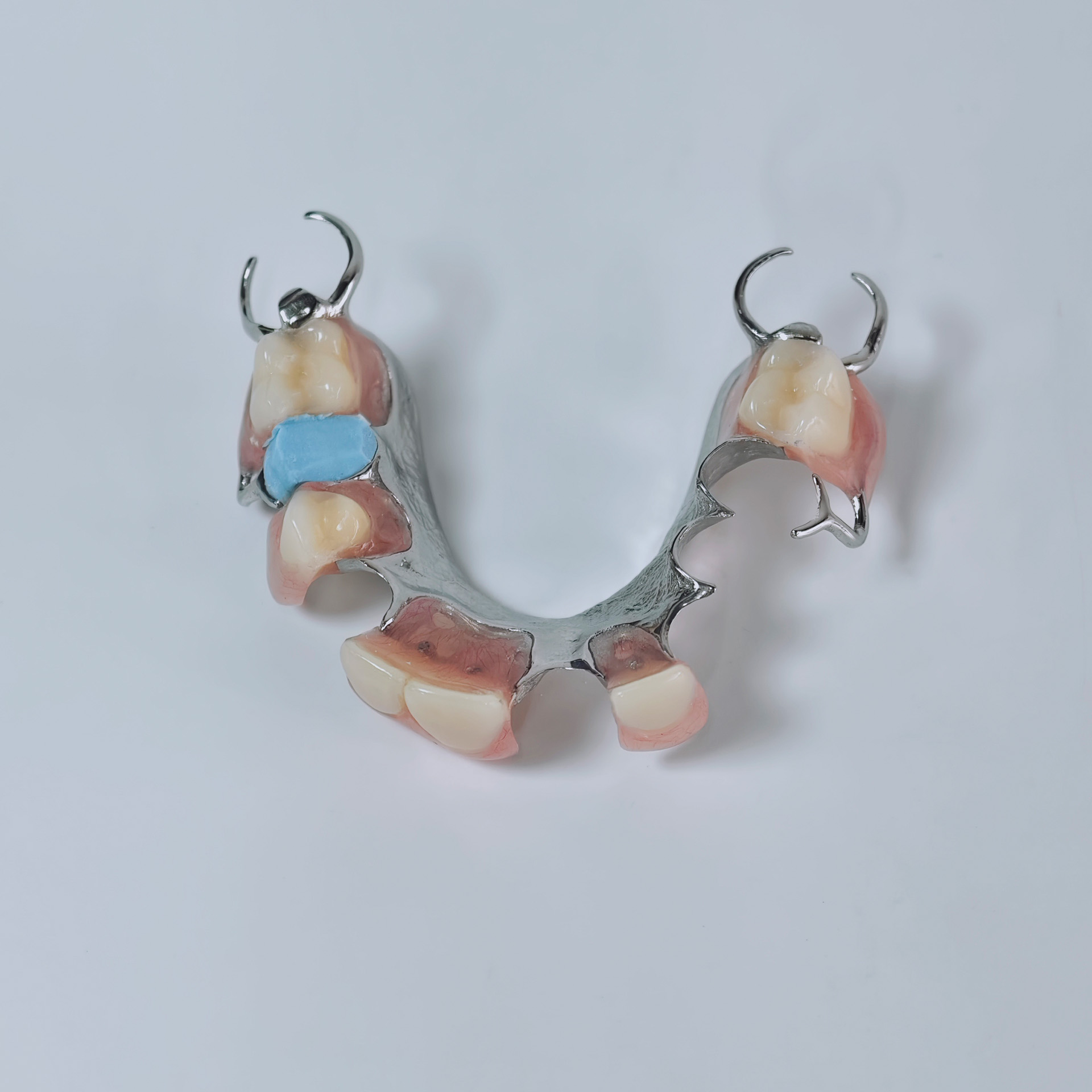 Cobalt chrome framework dentur