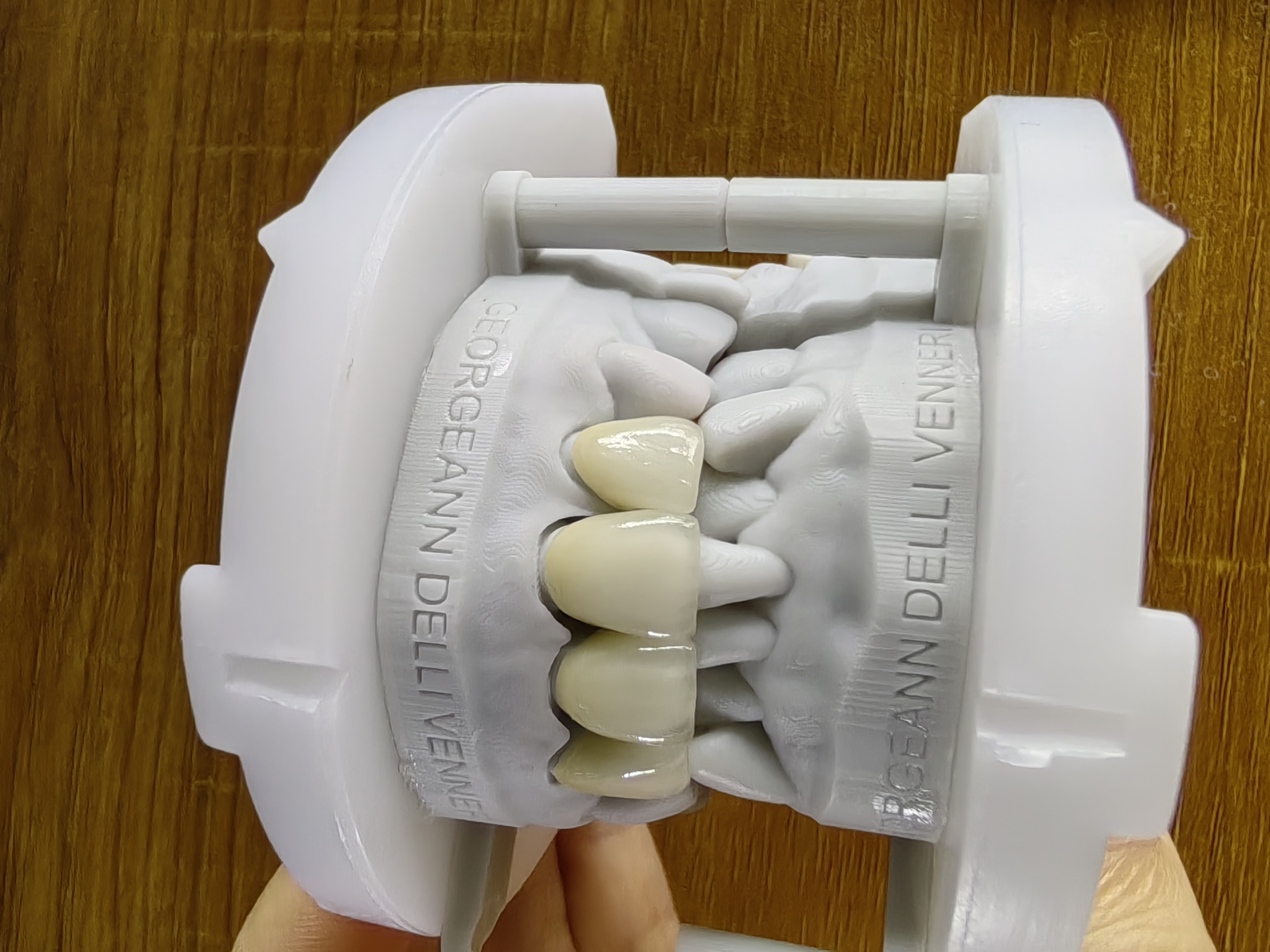 PFZ with Transparent in incisa