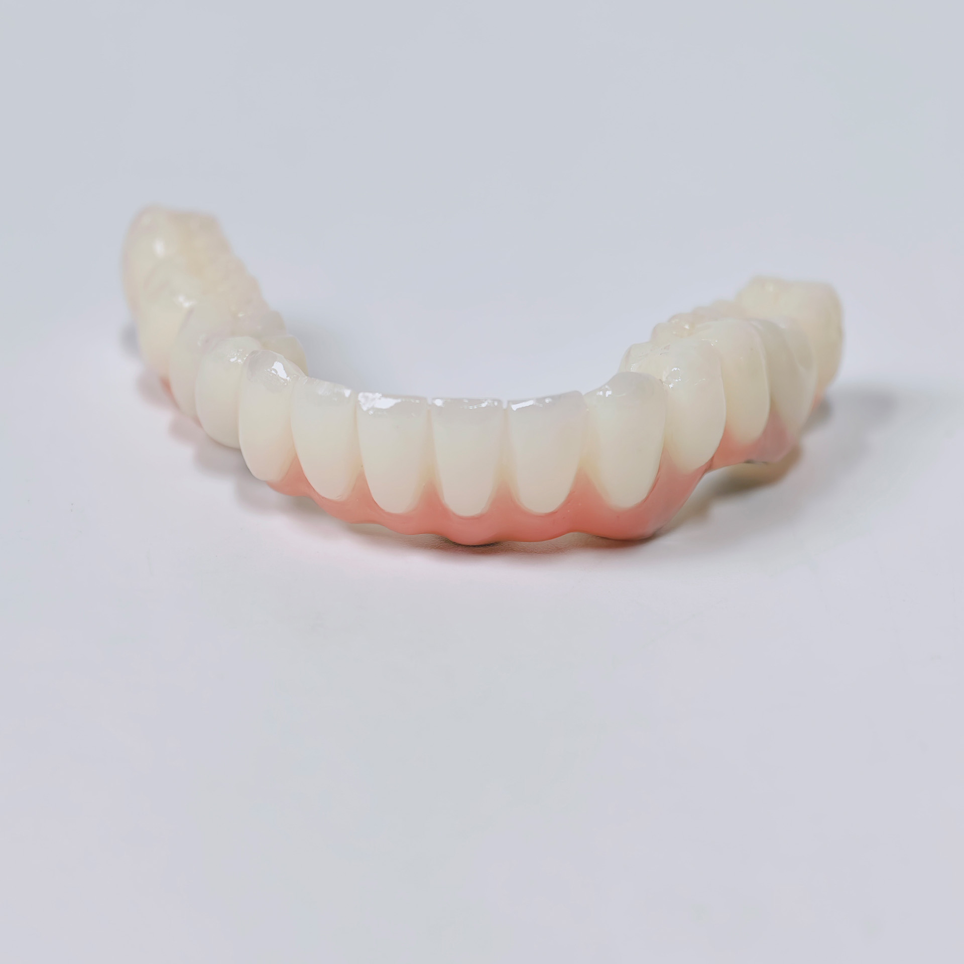 PMMA bridge with screw retaine