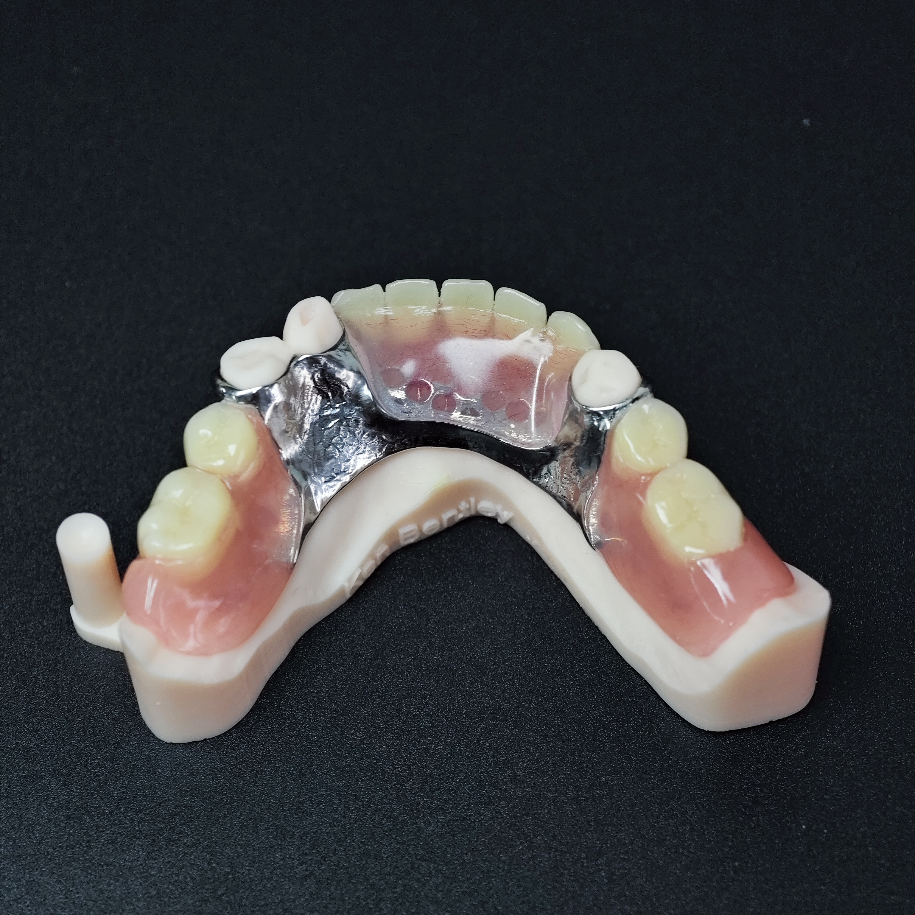 Cobalt chrome framework dentur