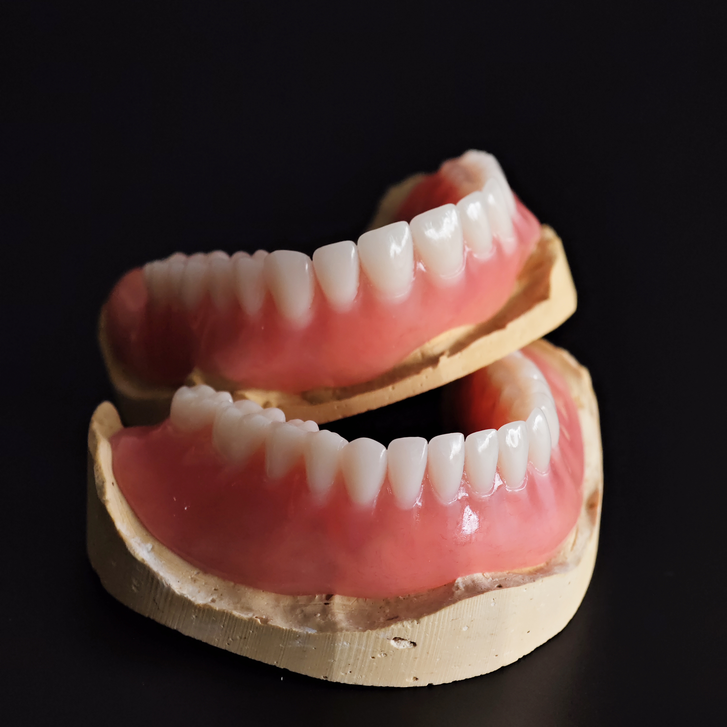 full-mouth acrylic denture