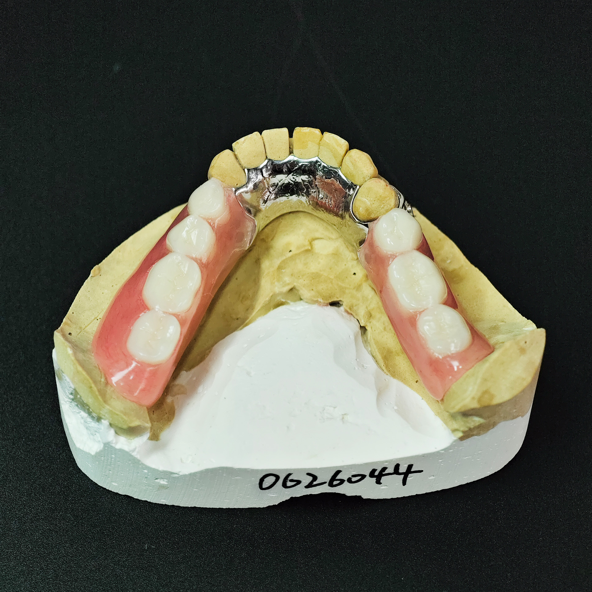 Cobalt chrome framework dentur