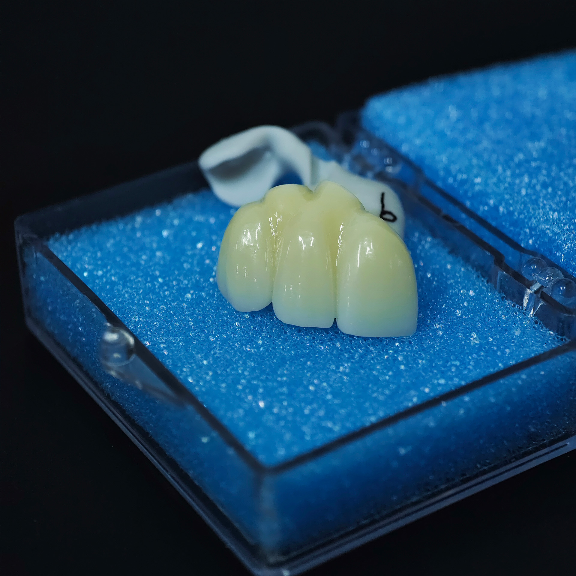 High - Strength Zirconia Bridg