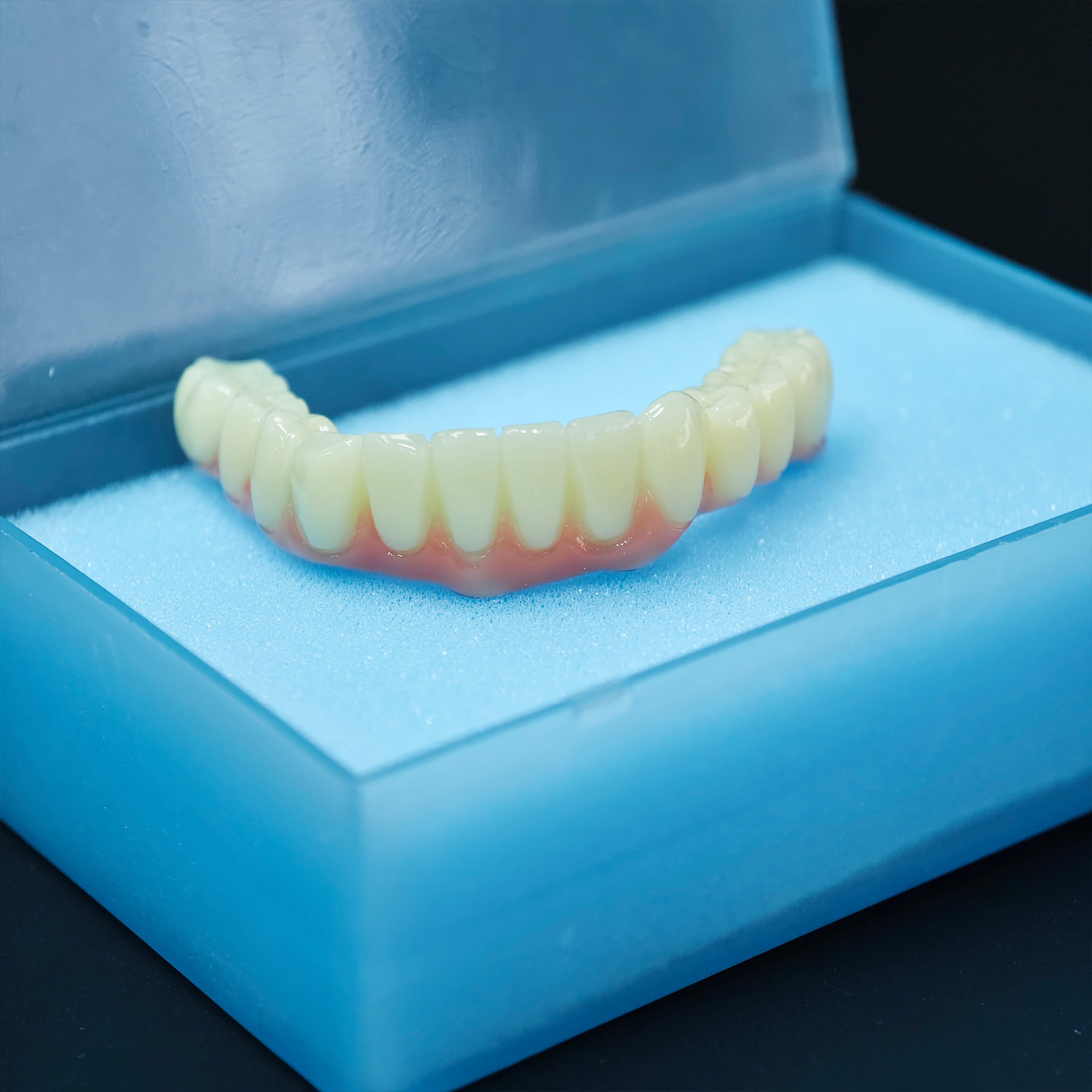 PMMA bridge with screw retaine