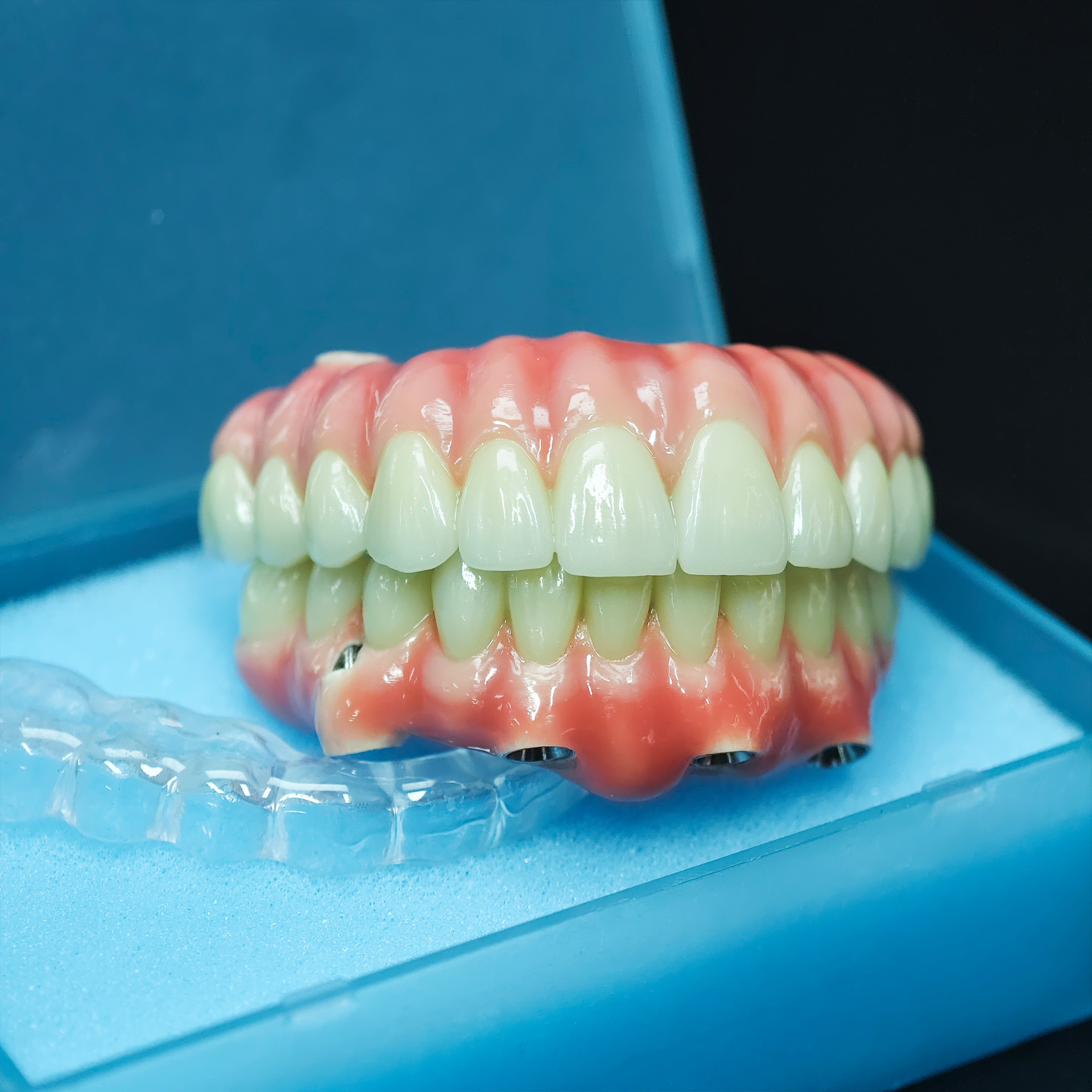 Zirconia-Enamel Hybrid Malo Br