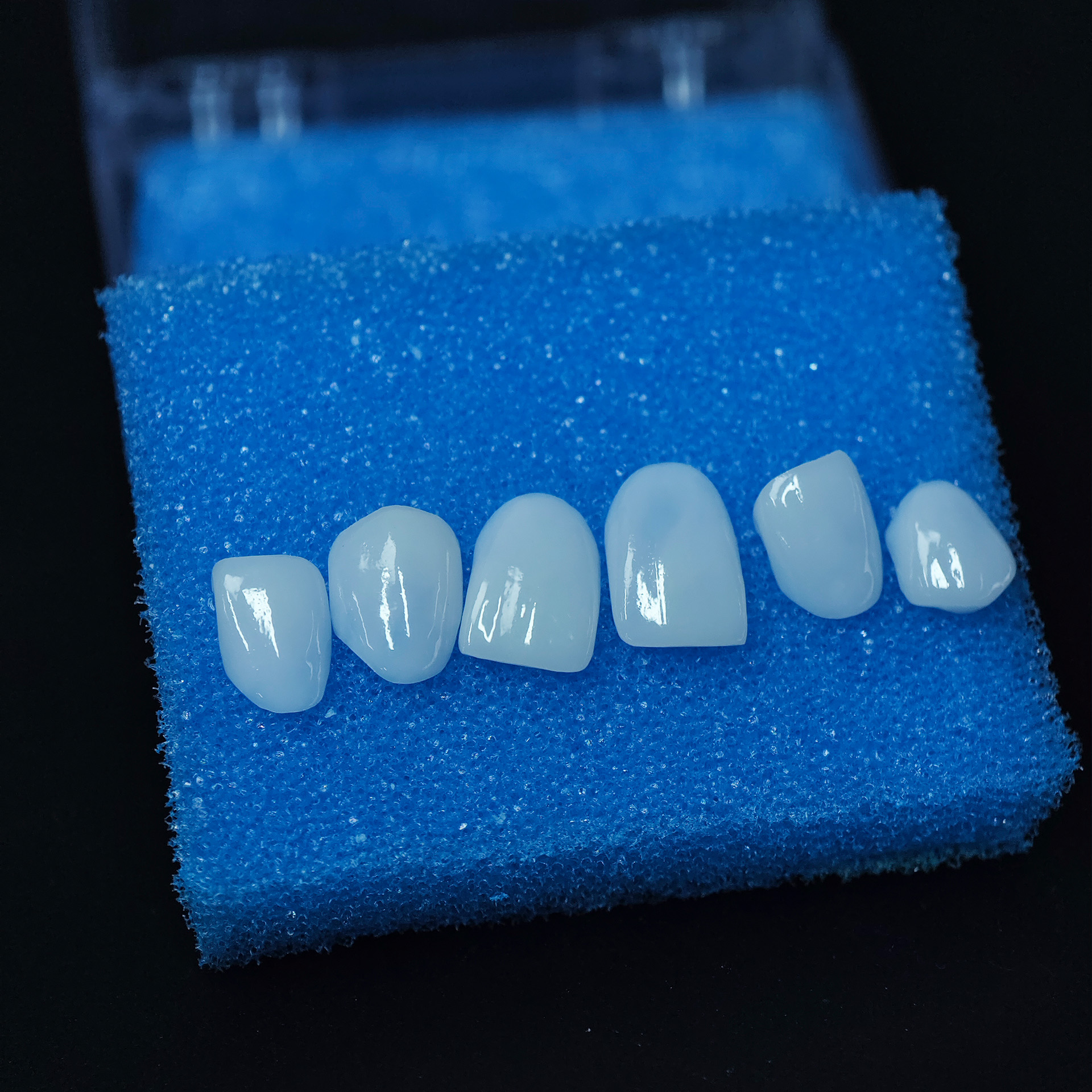 Ultra-thin emax veneer. High t